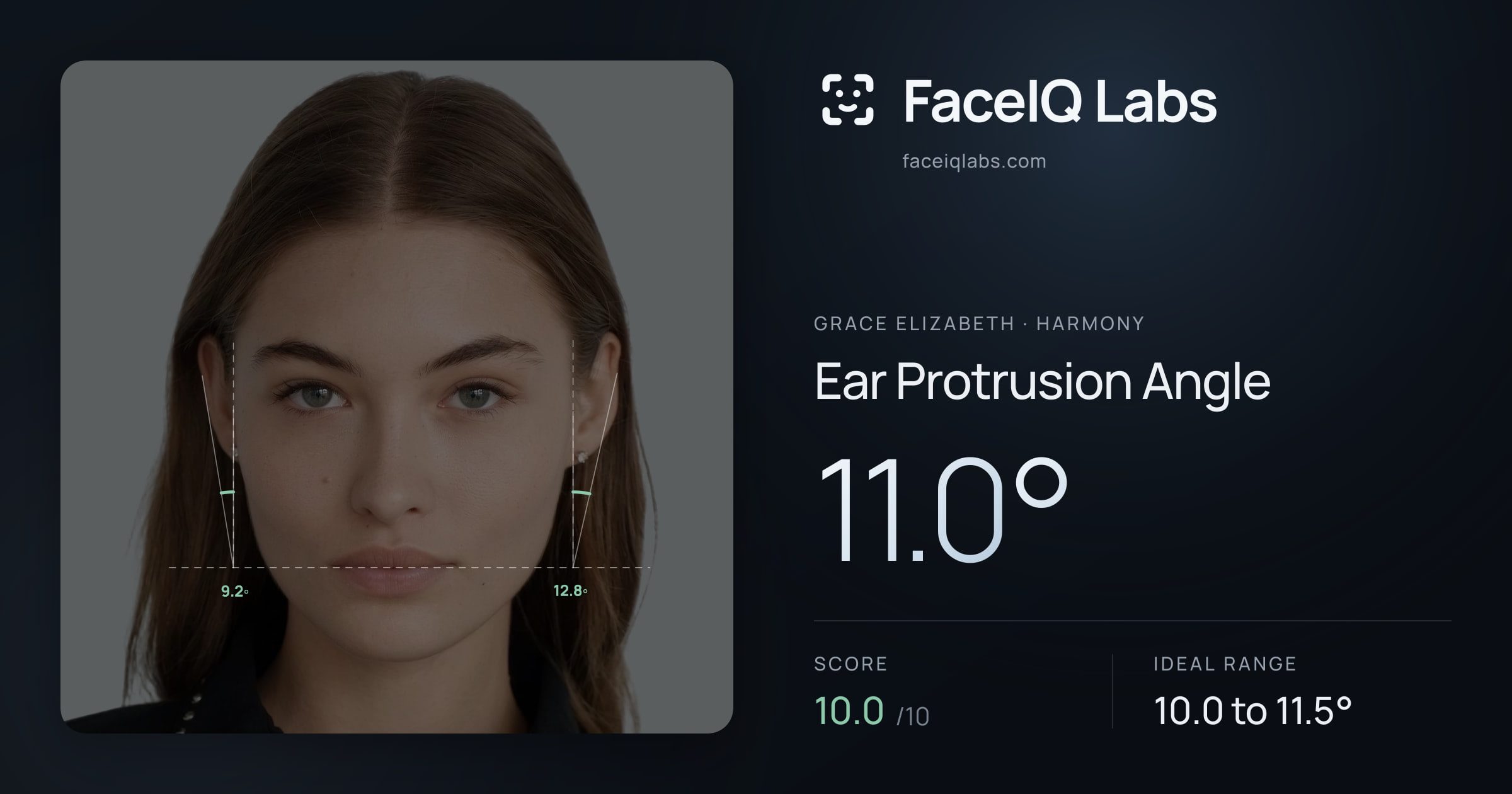 Grace Elizabeth Ear Protrusion Angle: 11.0°, drawn on the photo