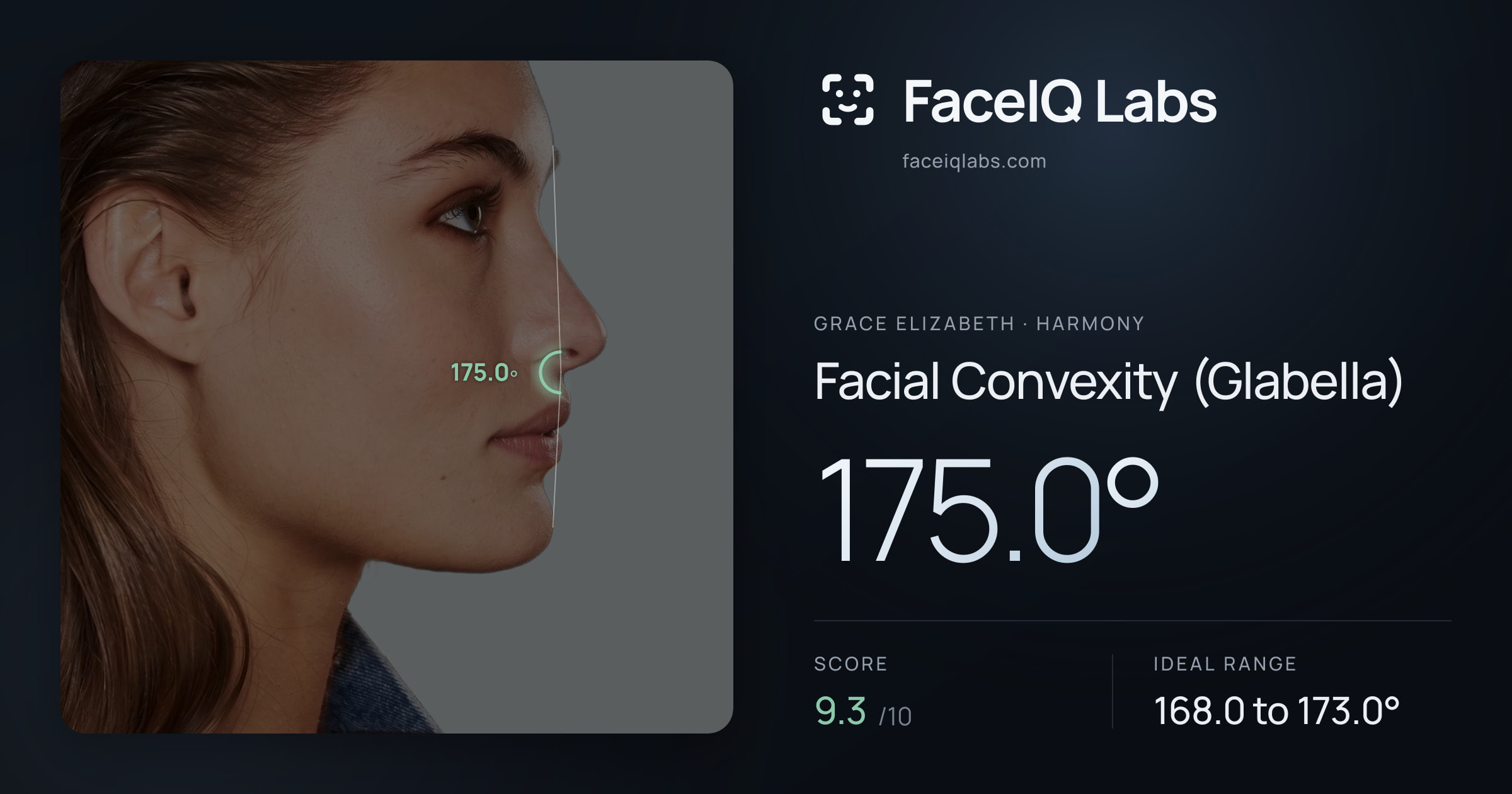 Grace Elizabeth Facial Convexity (Glabella): 175.0°, drawn on the photo