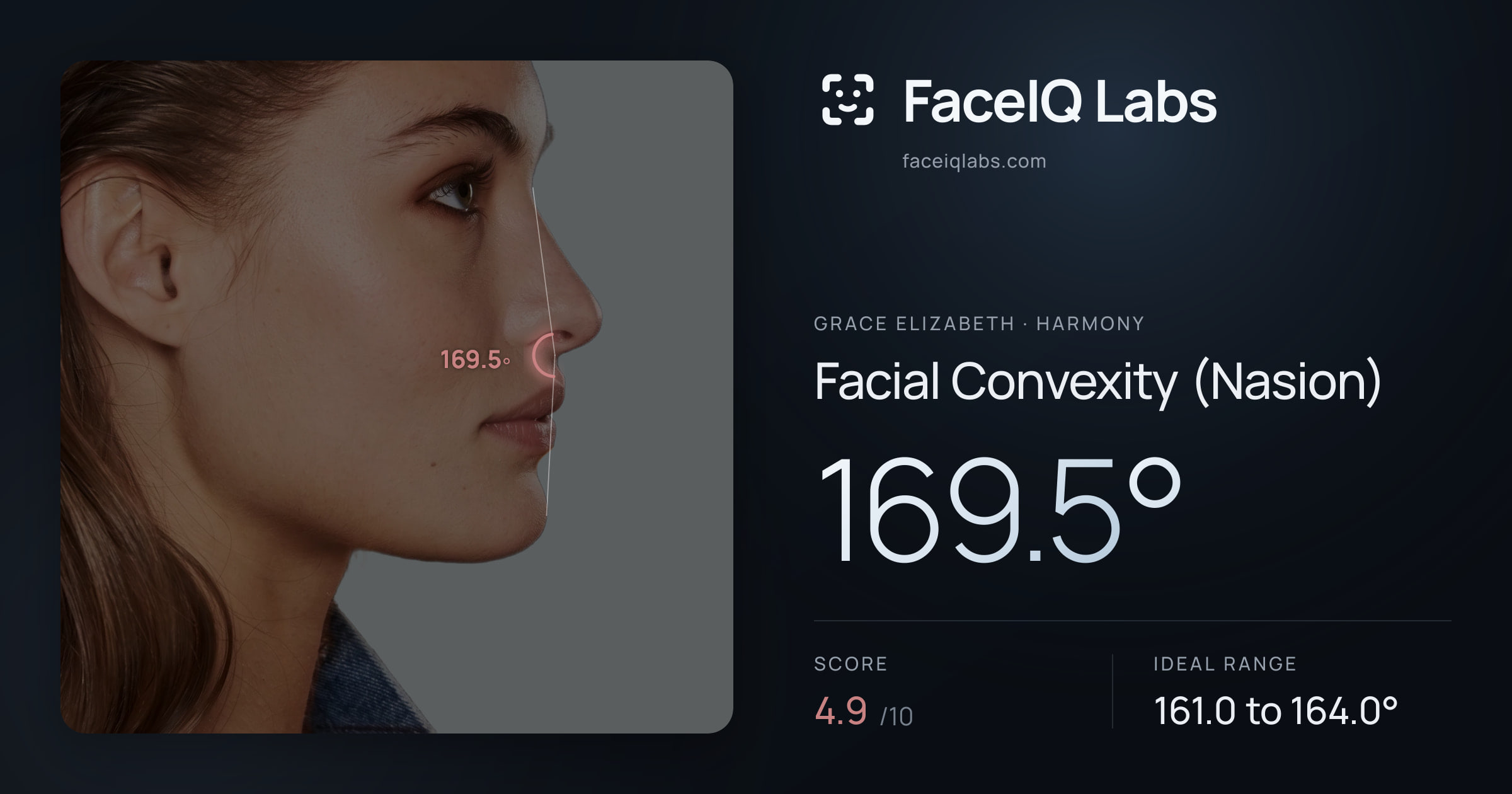 Grace Elizabeth Facial Convexity (Nasion): 169.5°, drawn on the photo