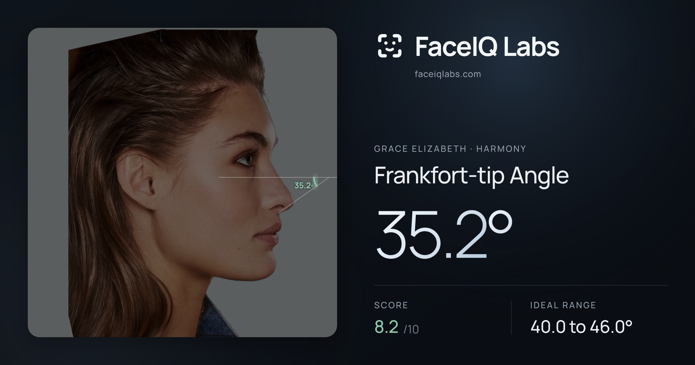 Grace Elizabeth Frankfort-tip Angle: 35.2°, drawn on the photo