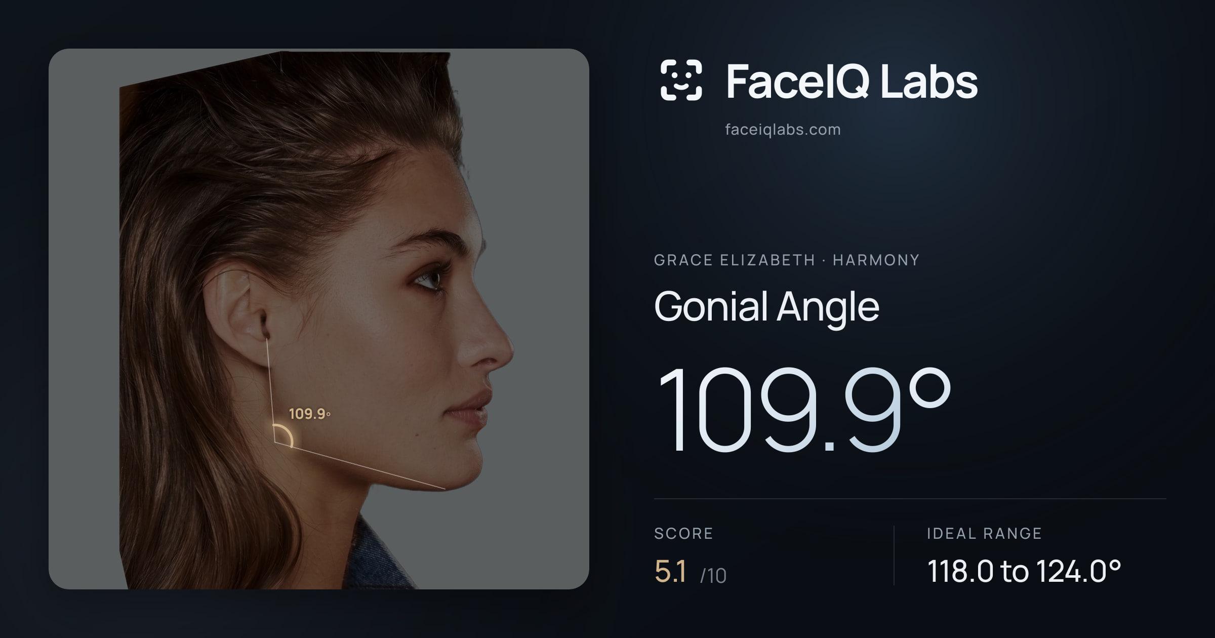 Grace Elizabeth Gonial Angle: 109.9°, drawn on the photo