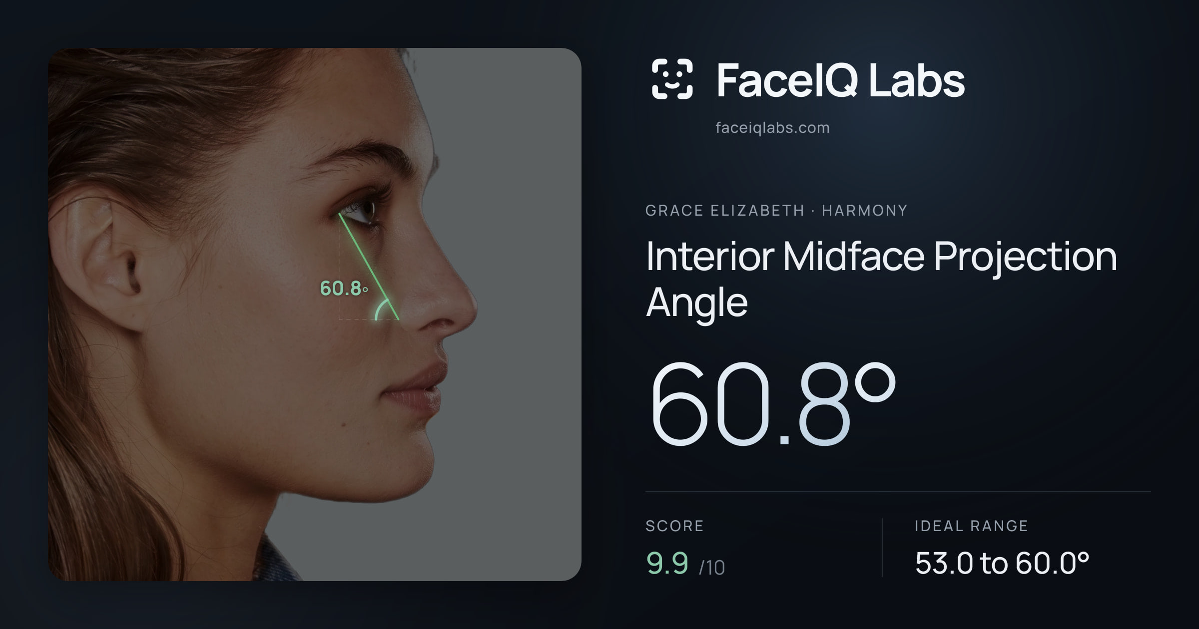 Grace Elizabeth Interior Midface Projection Angle: 60.8°, drawn on the photo
