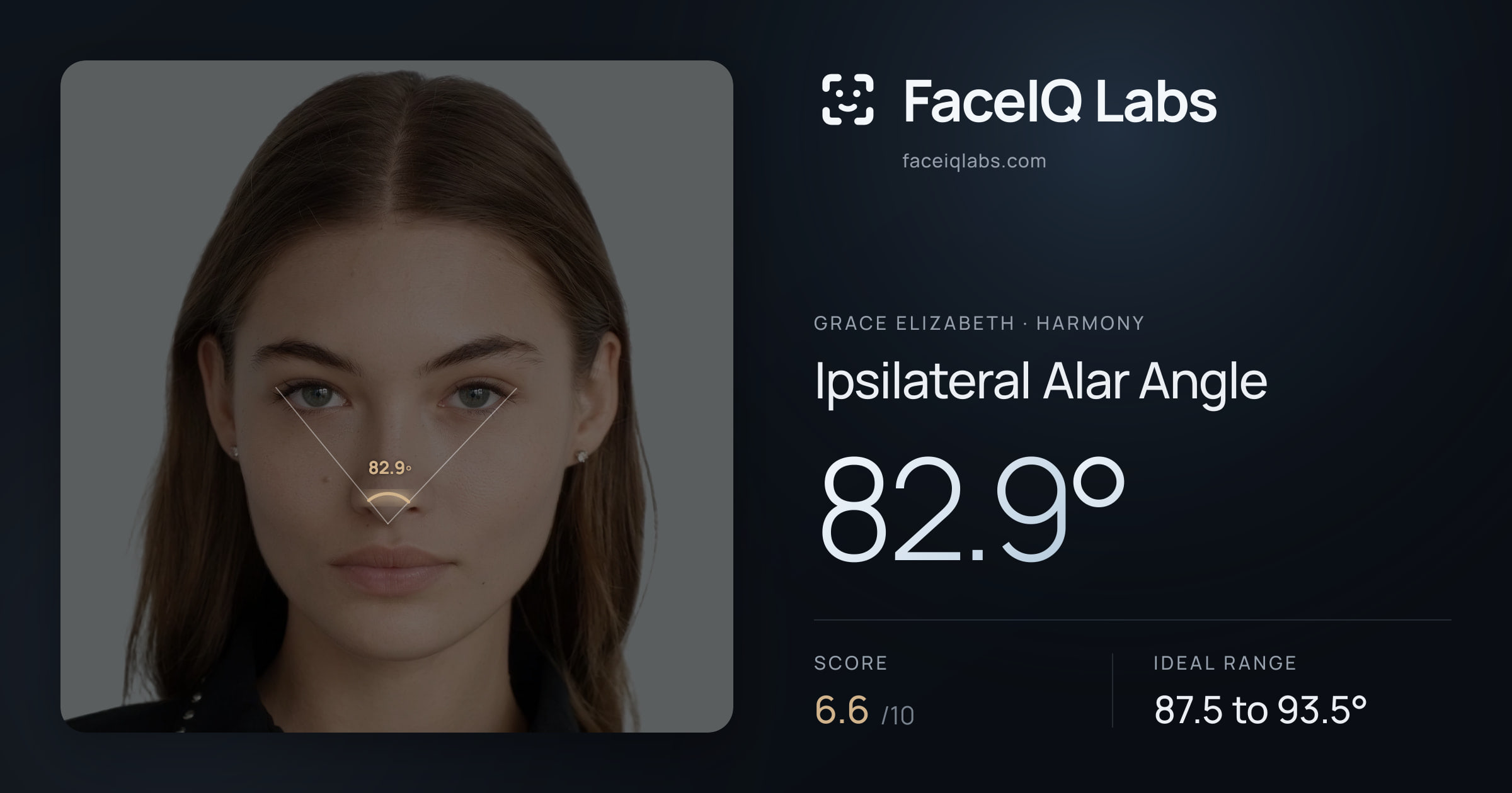 Grace Elizabeth Ipsilateral Alar Angle: 82.9°, drawn on the photo
