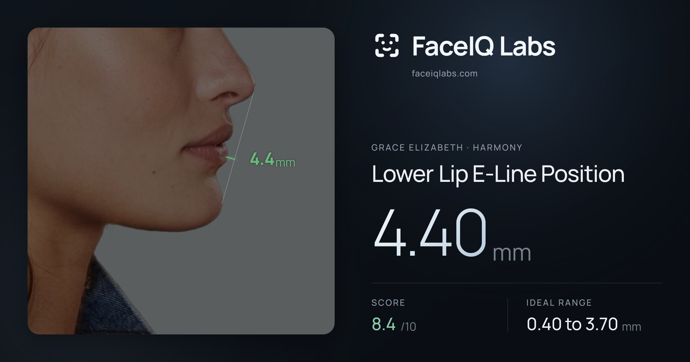 Grace Elizabeth Lower Lip E-Line Position: 4.40mm, drawn on the photo