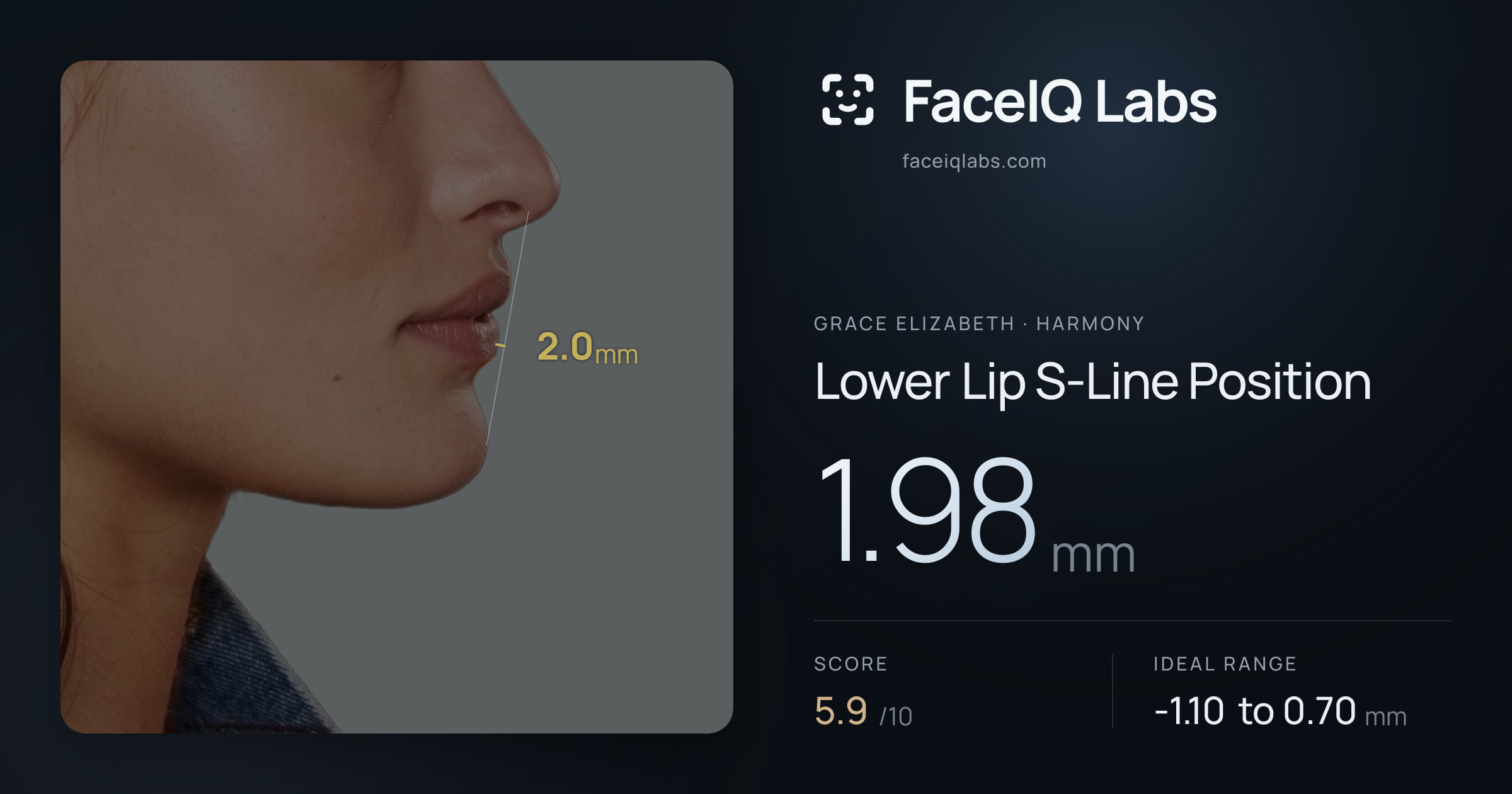 Grace Elizabeth Lower Lip S-Line Position: 1.98mm, drawn on the photo