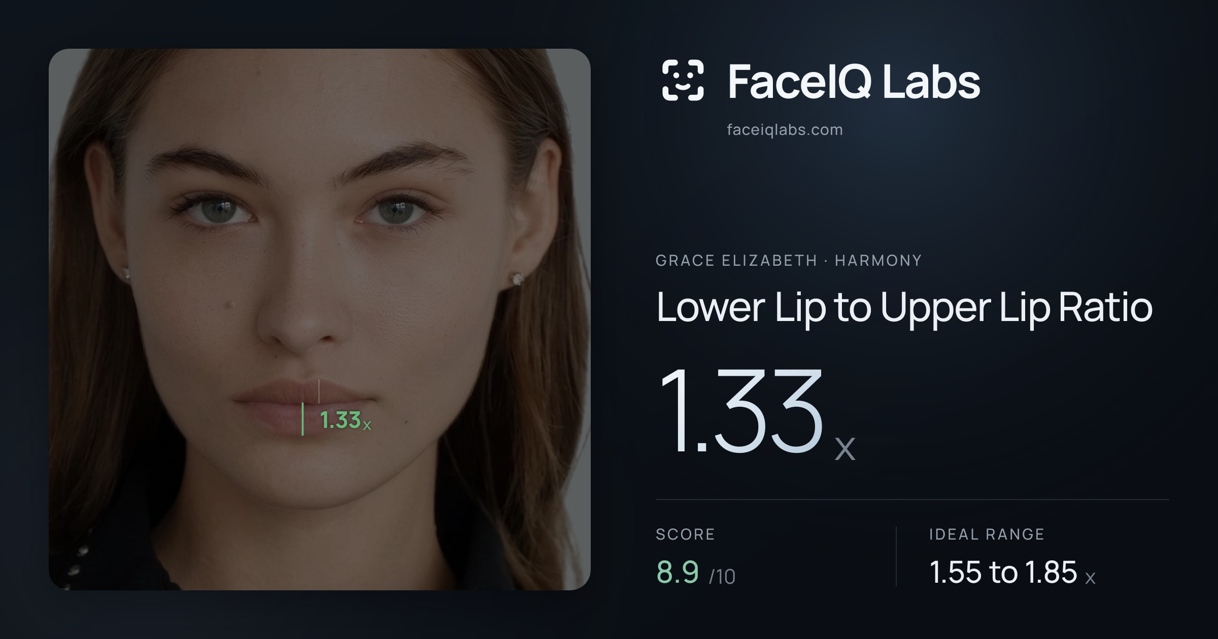 Grace Elizabeth Lower Lip to Upper Lip Ratio: 1.33x, drawn on the photo
