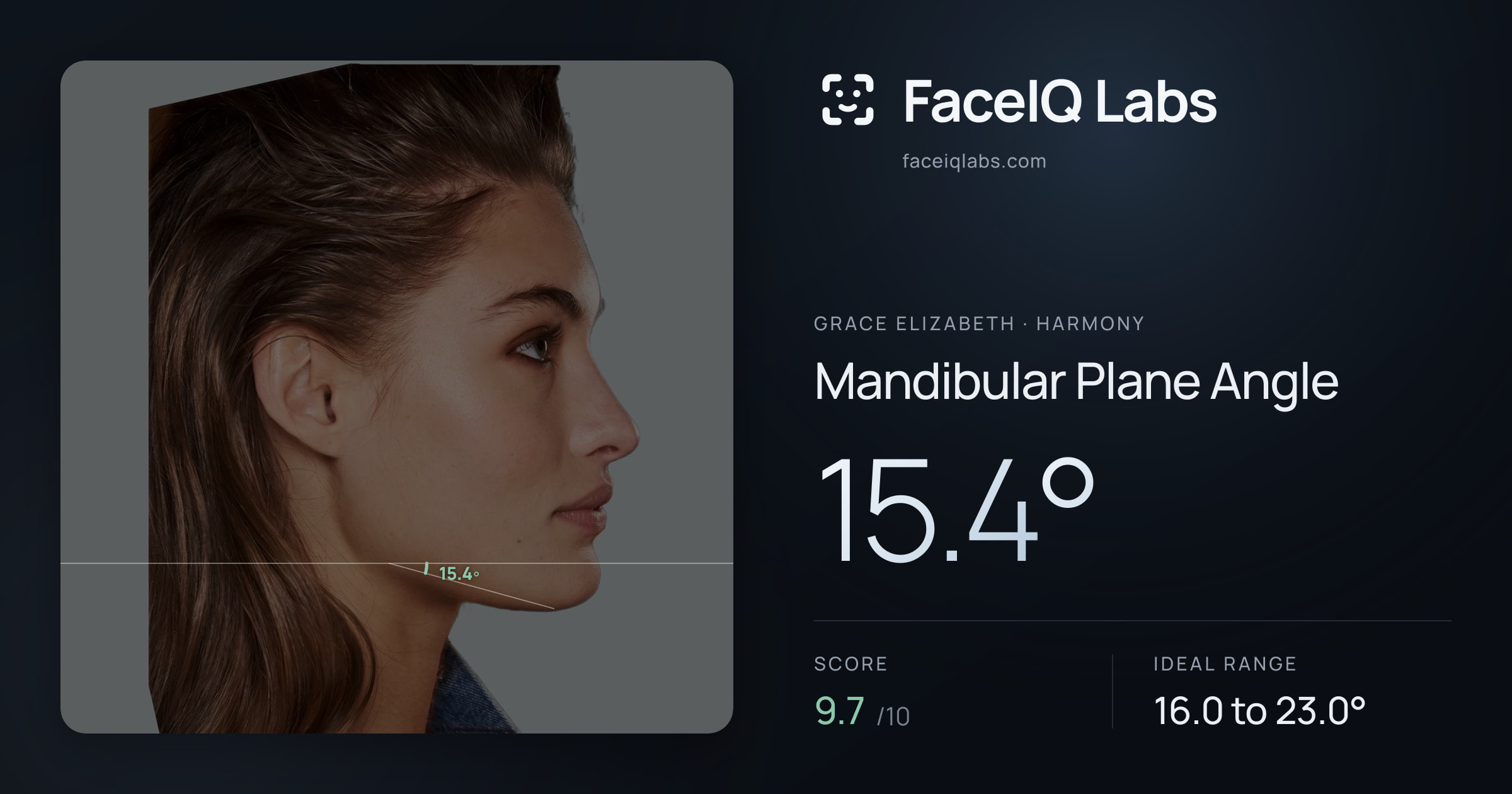 Grace Elizabeth Mandibular Plane Angle: 15.4°, drawn on the photo