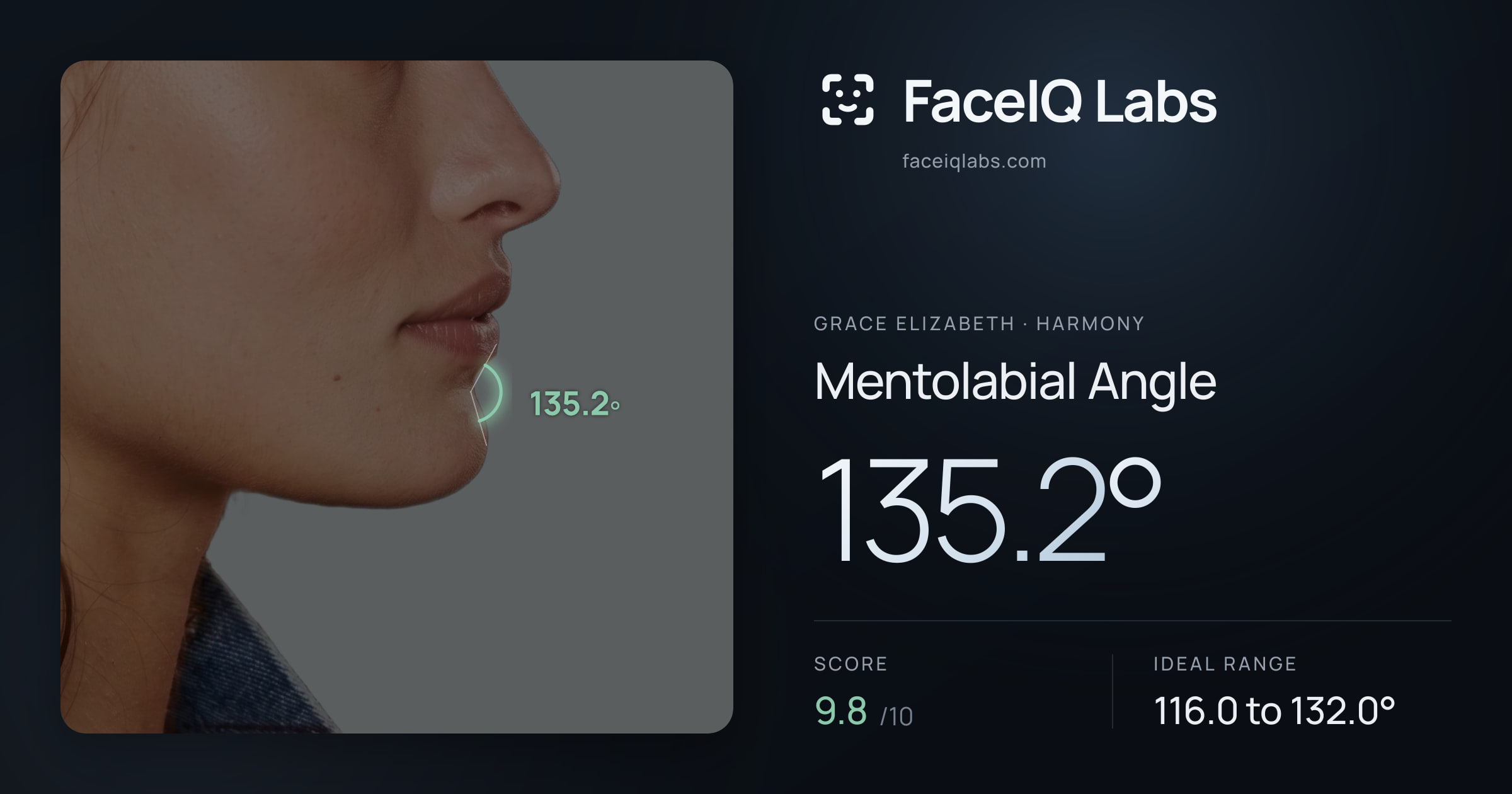 Grace Elizabeth Mentolabial Angle: 135.2°, drawn on the photo