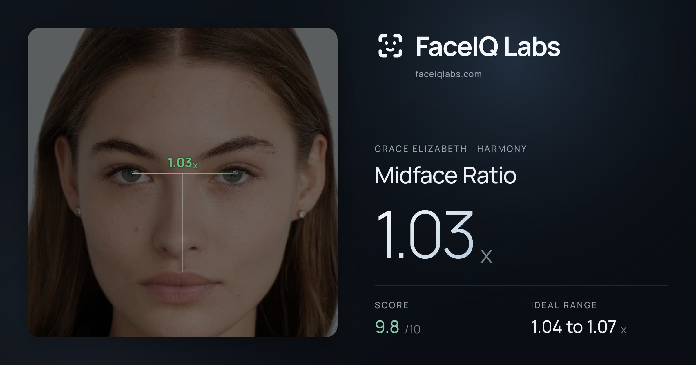 Grace Elizabeth Midface Ratio: 1.03x, drawn on the photo