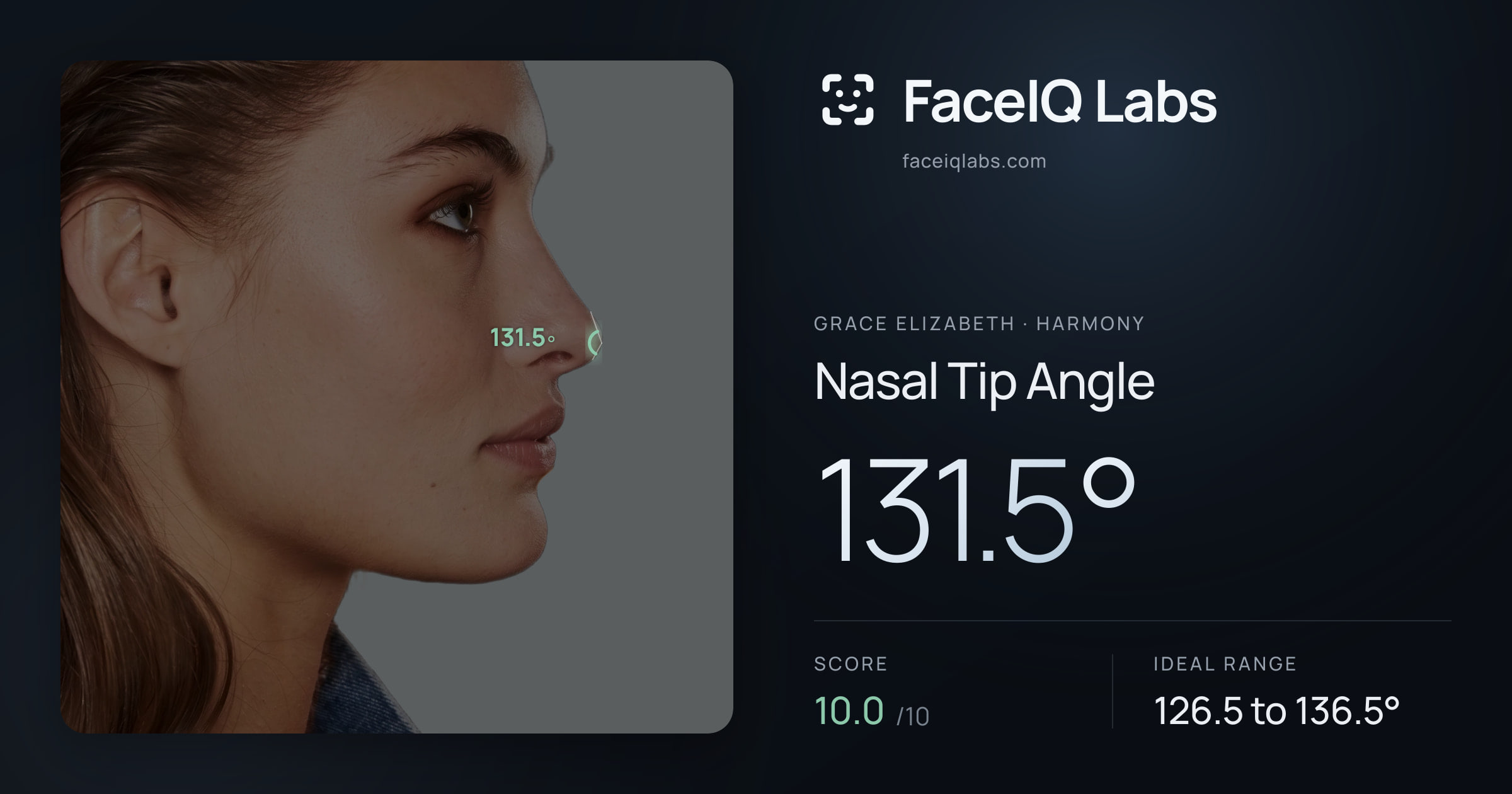 Grace Elizabeth Nasal Tip Angle: 131.5°, drawn on the photo