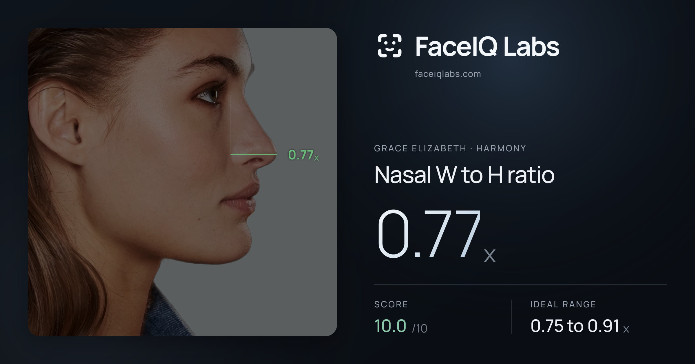Grace Elizabeth Nasal W to H ratio: 0.77x, drawn on the photo