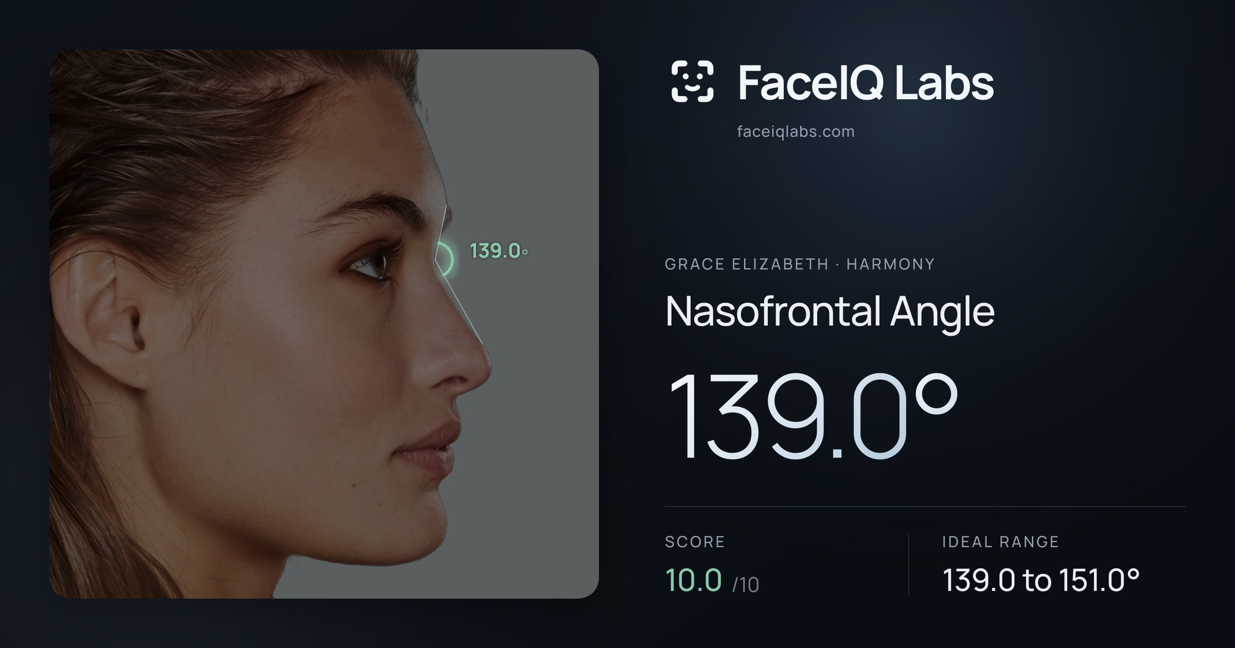 Grace Elizabeth Nasofrontal Angle: 139.0°, drawn on the photo