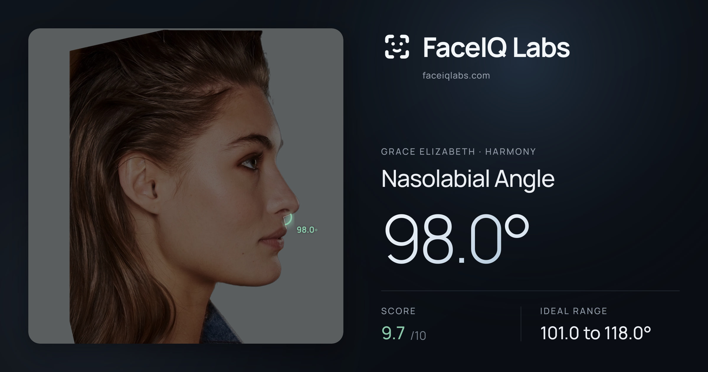 Grace Elizabeth Nasolabial Angle: 98.0°, drawn on the photo