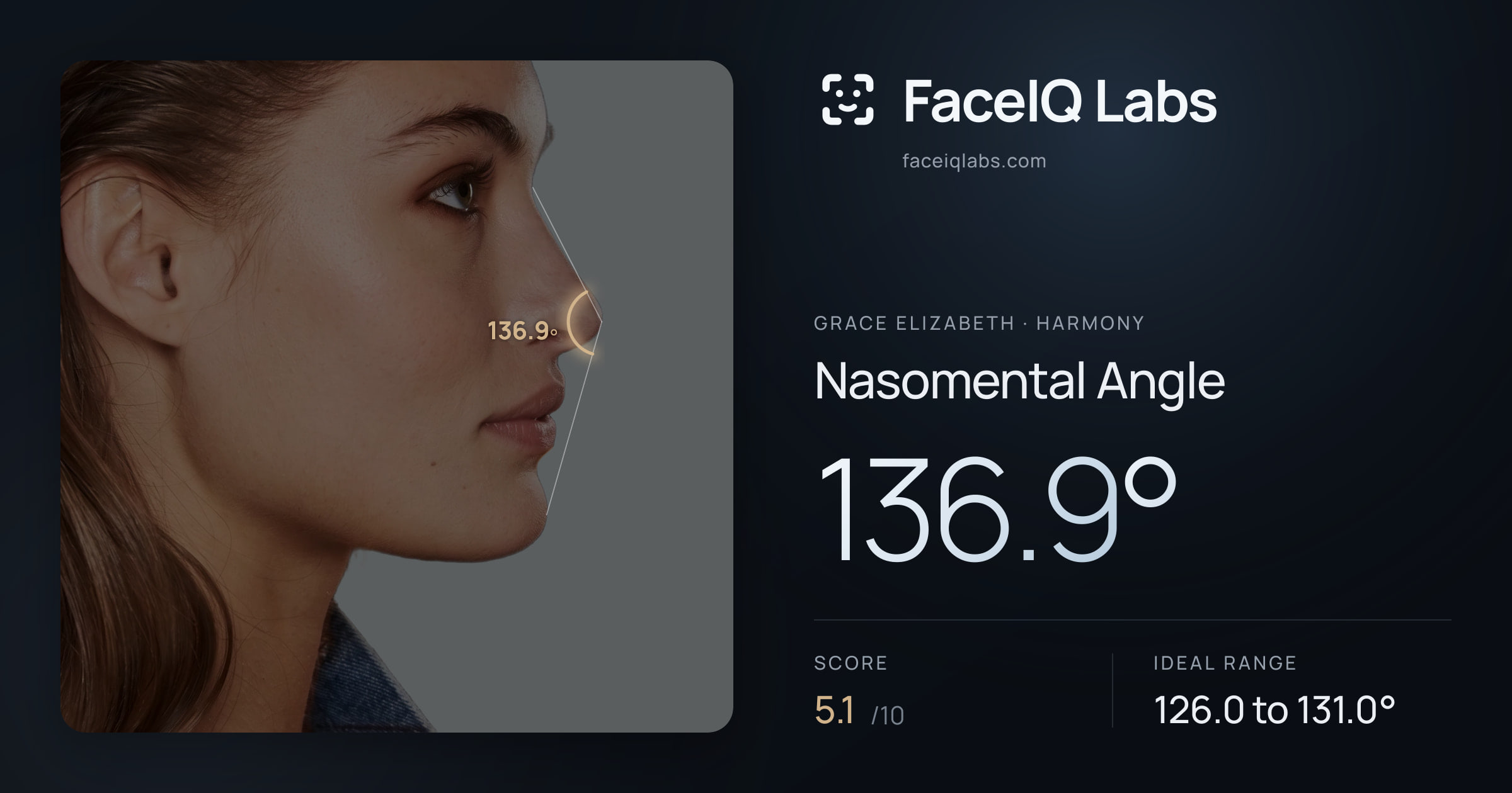 Grace Elizabeth Nasomental Angle: 136.9°, drawn on the photo