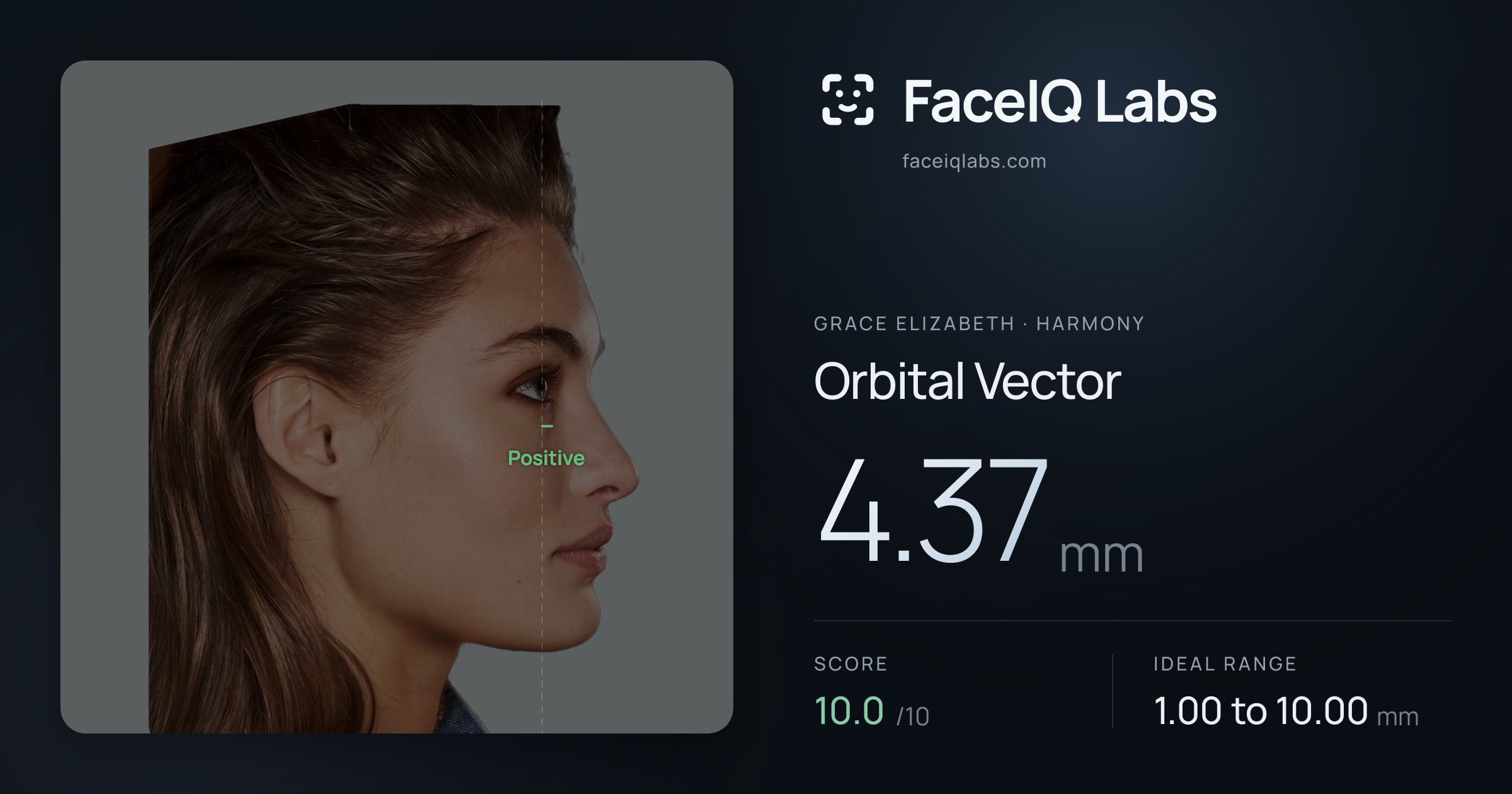 Grace Elizabeth Orbital Vector: 4.37mm, drawn on the photo