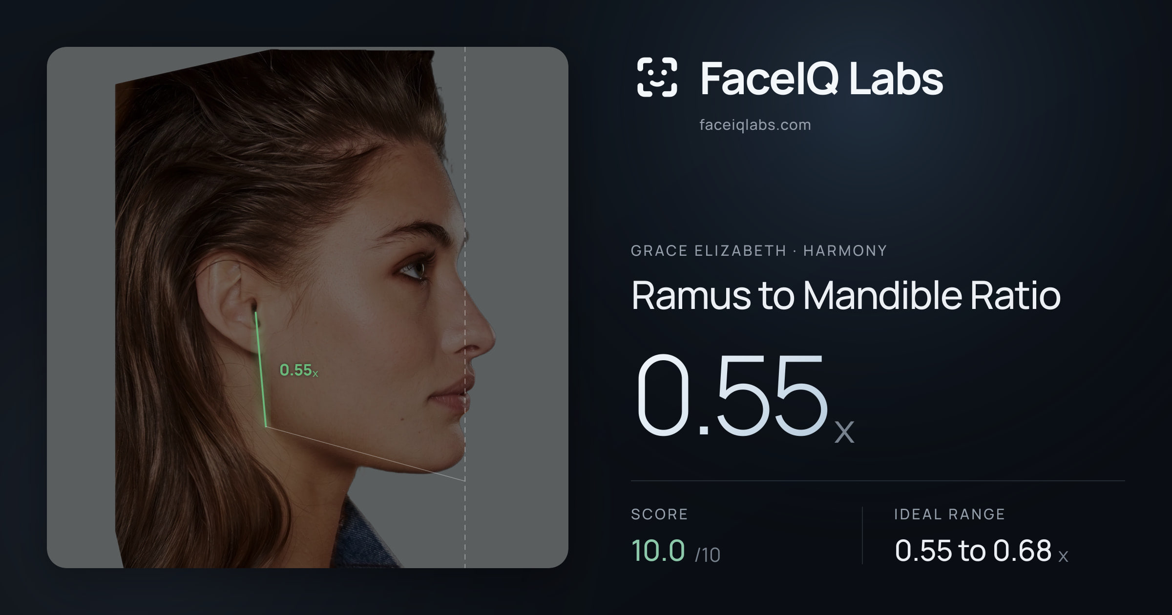 Grace Elizabeth Ramus to Mandible Ratio: 0.55x, drawn on the photo
