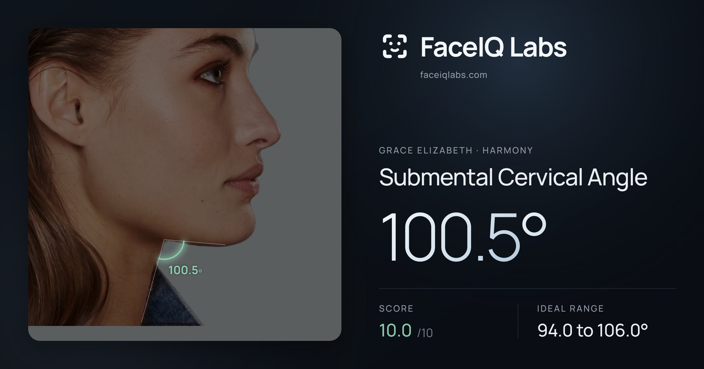 Grace Elizabeth Submental Cervical Angle: 100.5°, drawn on the photo