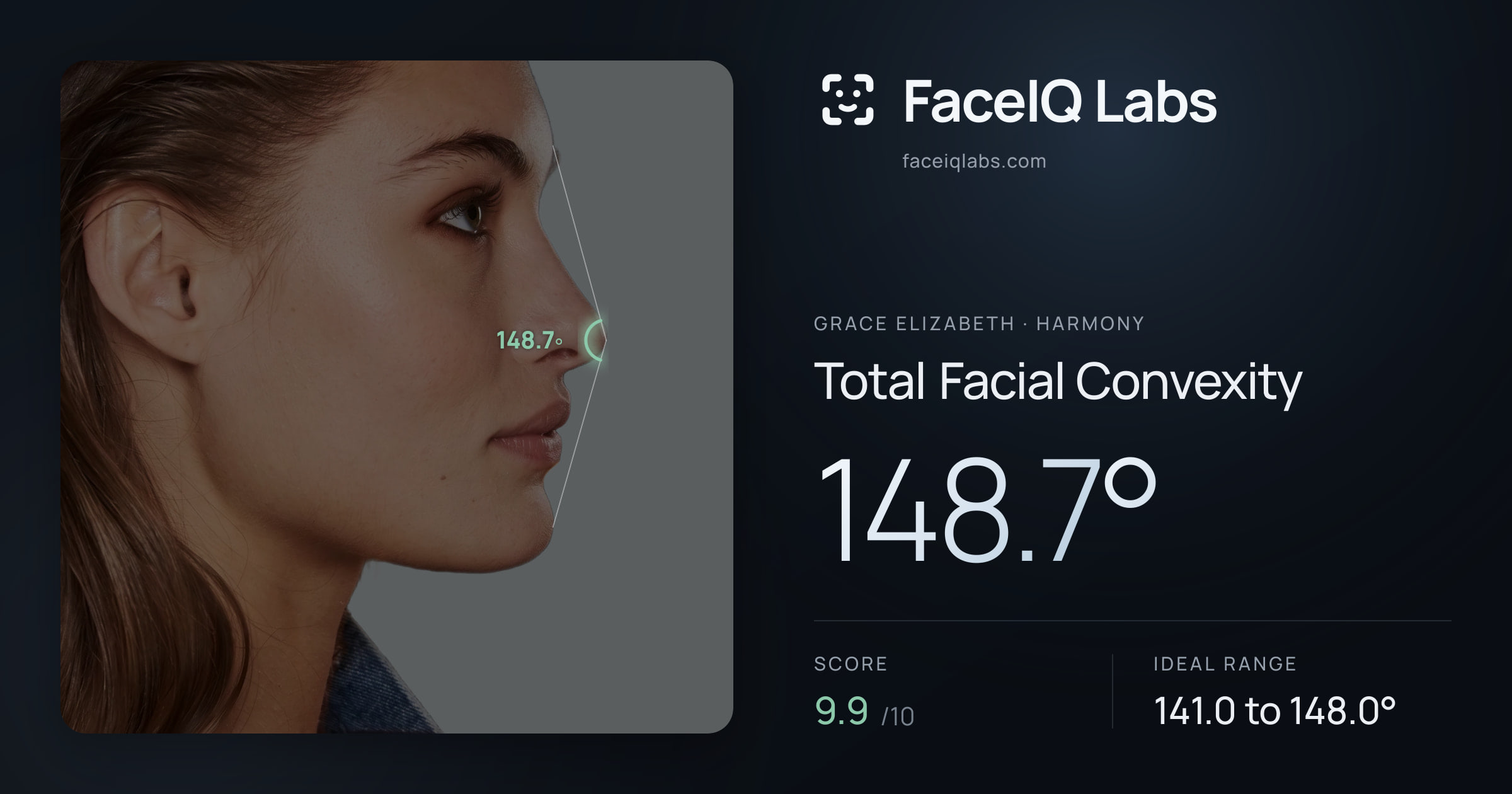 Grace Elizabeth Total Facial Convexity: 148.7°, drawn on the photo