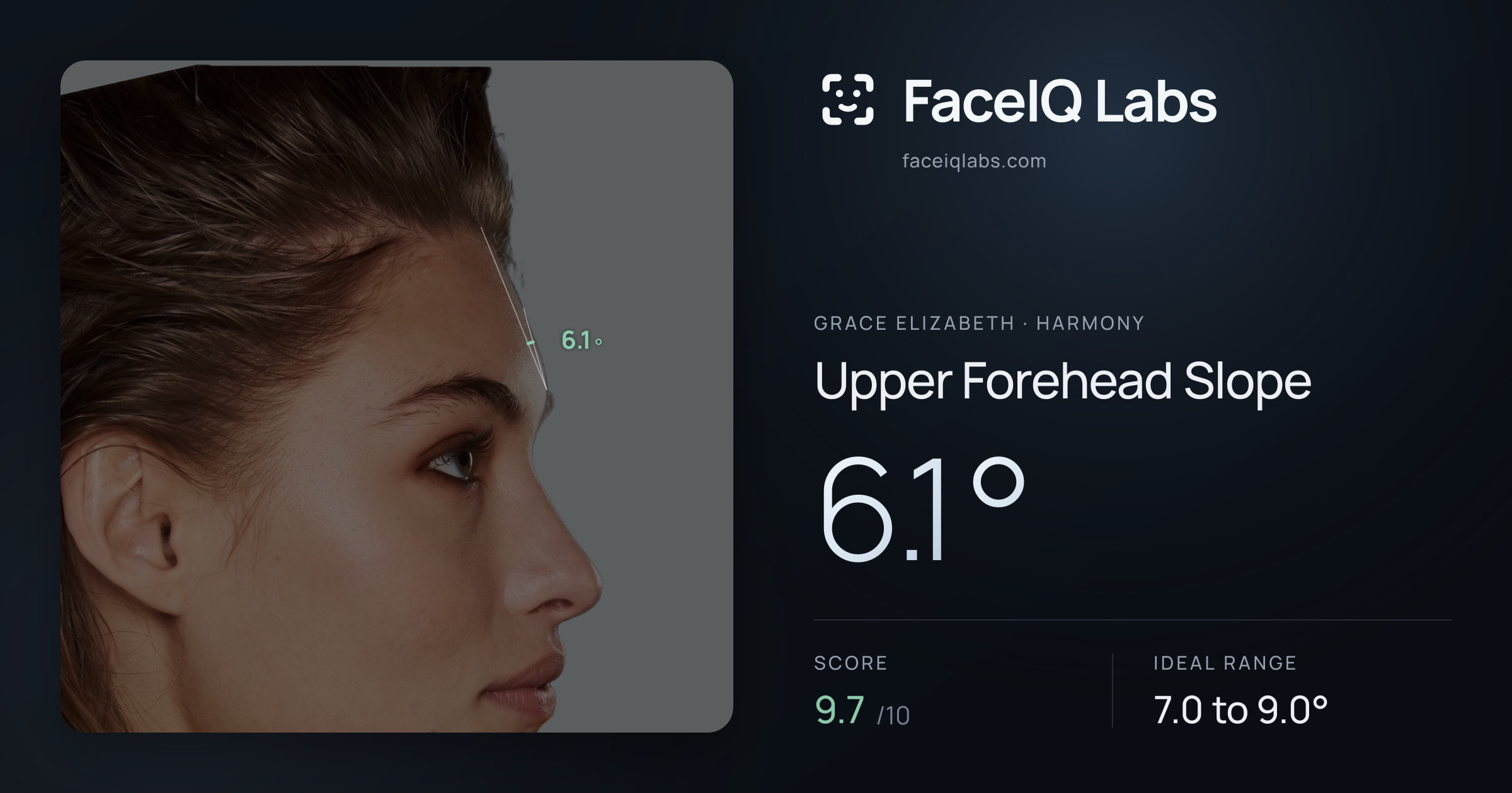 Grace Elizabeth Upper Forehead Slope: 6.1°, drawn on the photo