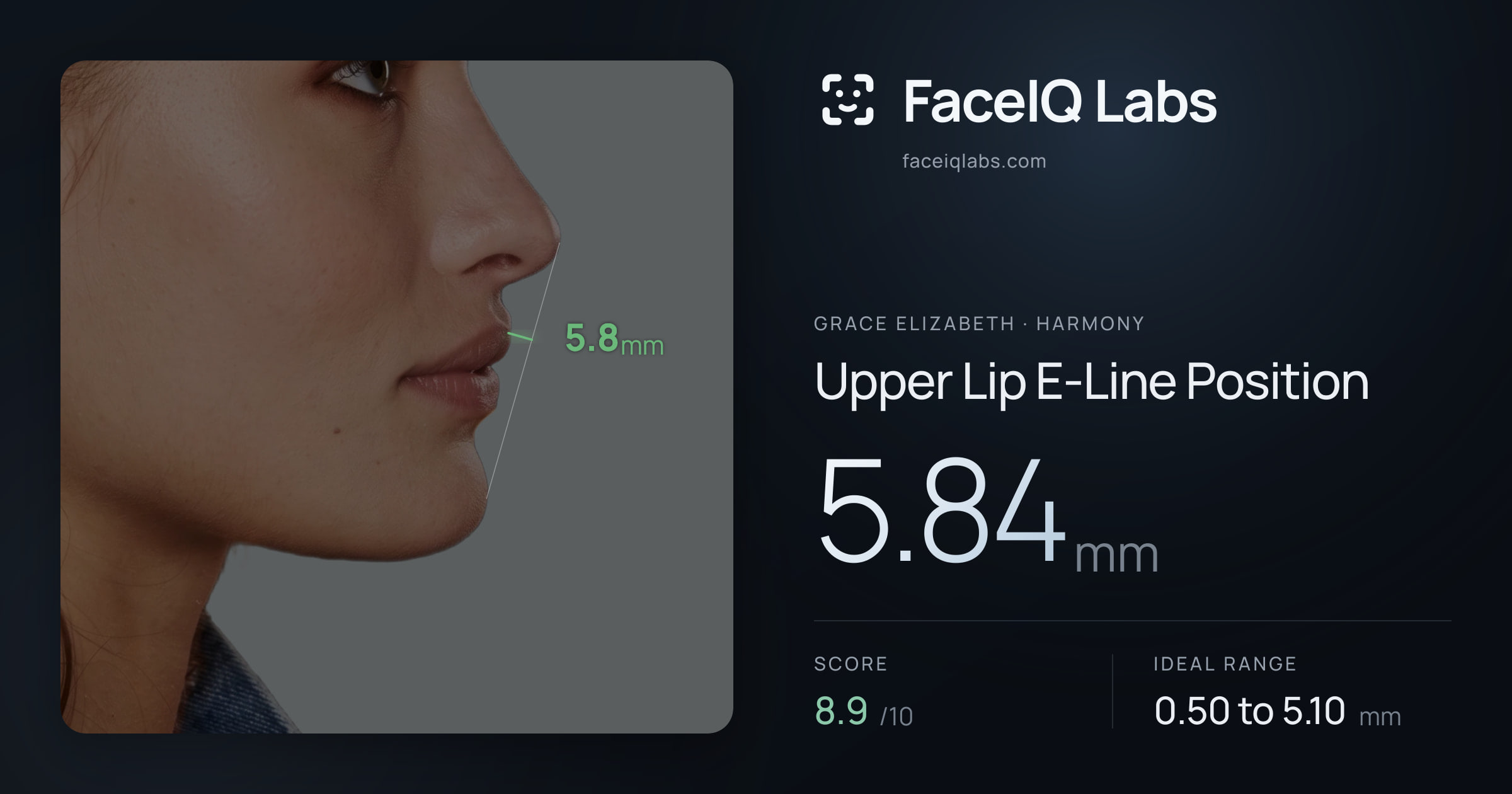 Grace Elizabeth Upper Lip E-Line Position: 5.84mm, drawn on the photo