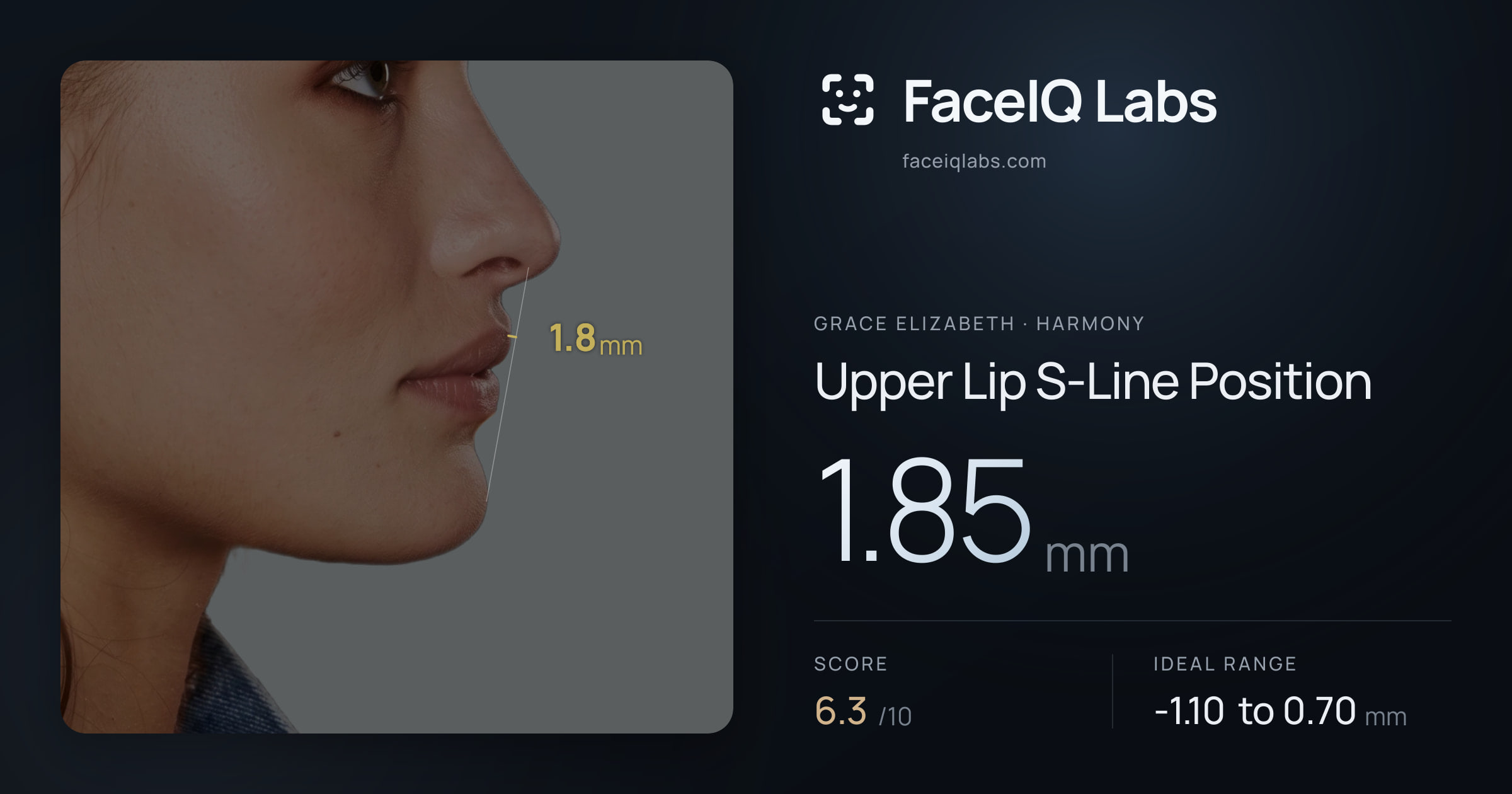 Grace Elizabeth Upper Lip S-Line Position: 1.85mm, drawn on the photo