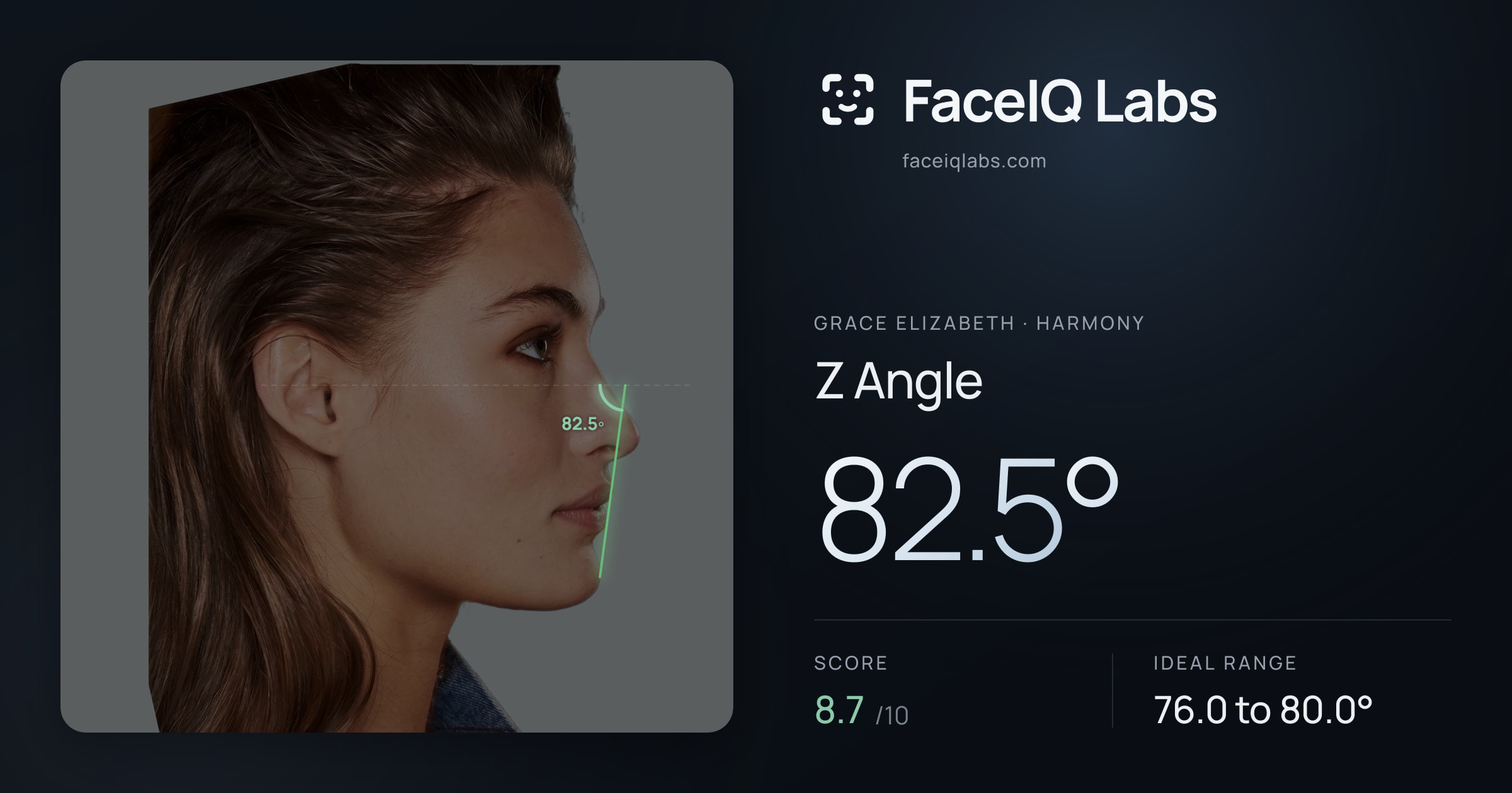 Grace Elizabeth Z Angle: 82.5°, drawn on the photo