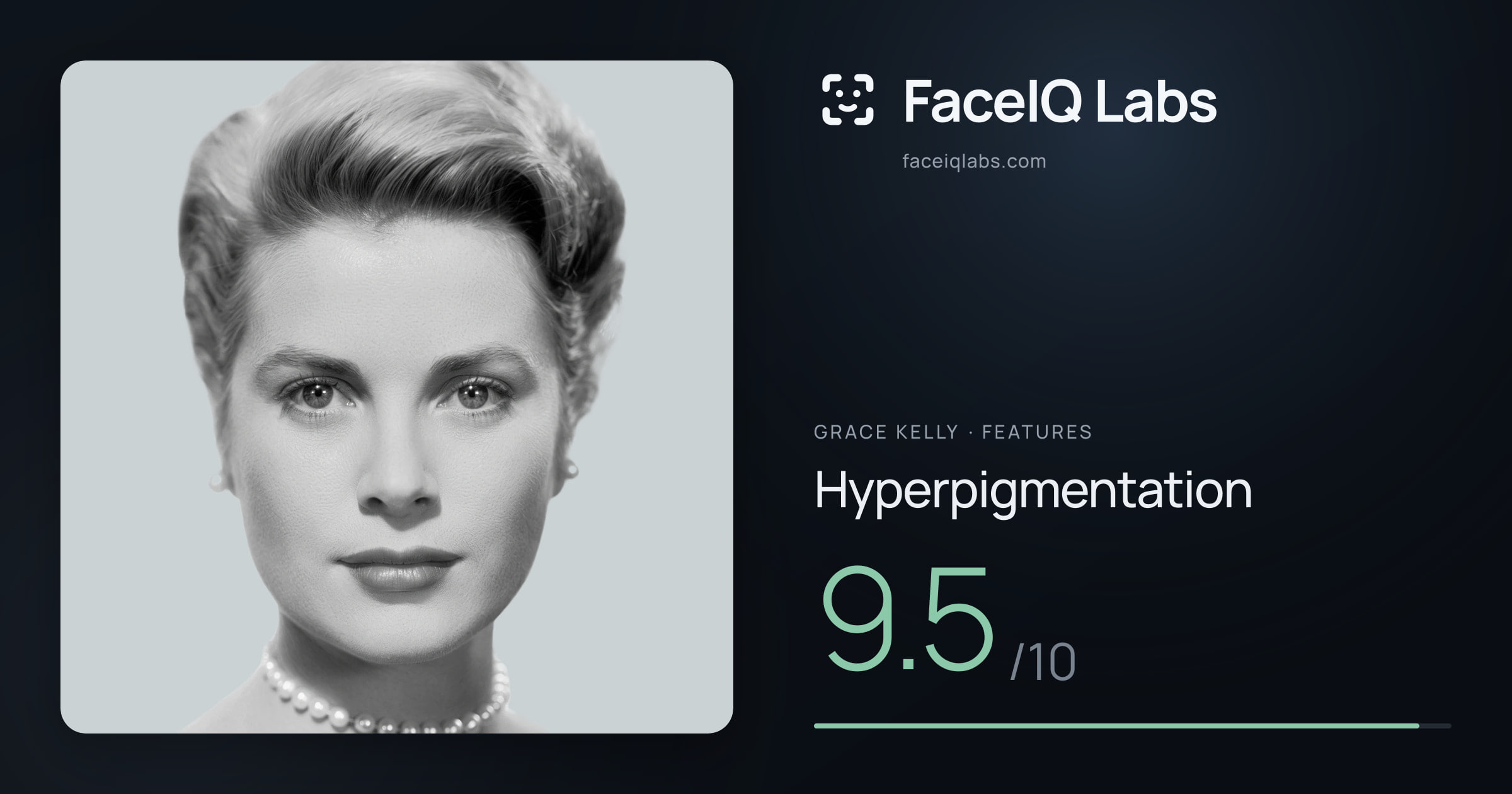 Grace Kelly Hyperpigmentation: 9.5/10, drawn on the photo