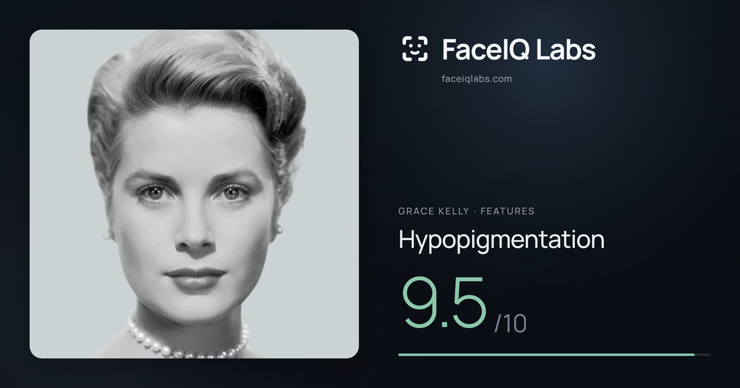 Grace Kelly Hypopigmentation: 9.5/10, drawn on the photo
