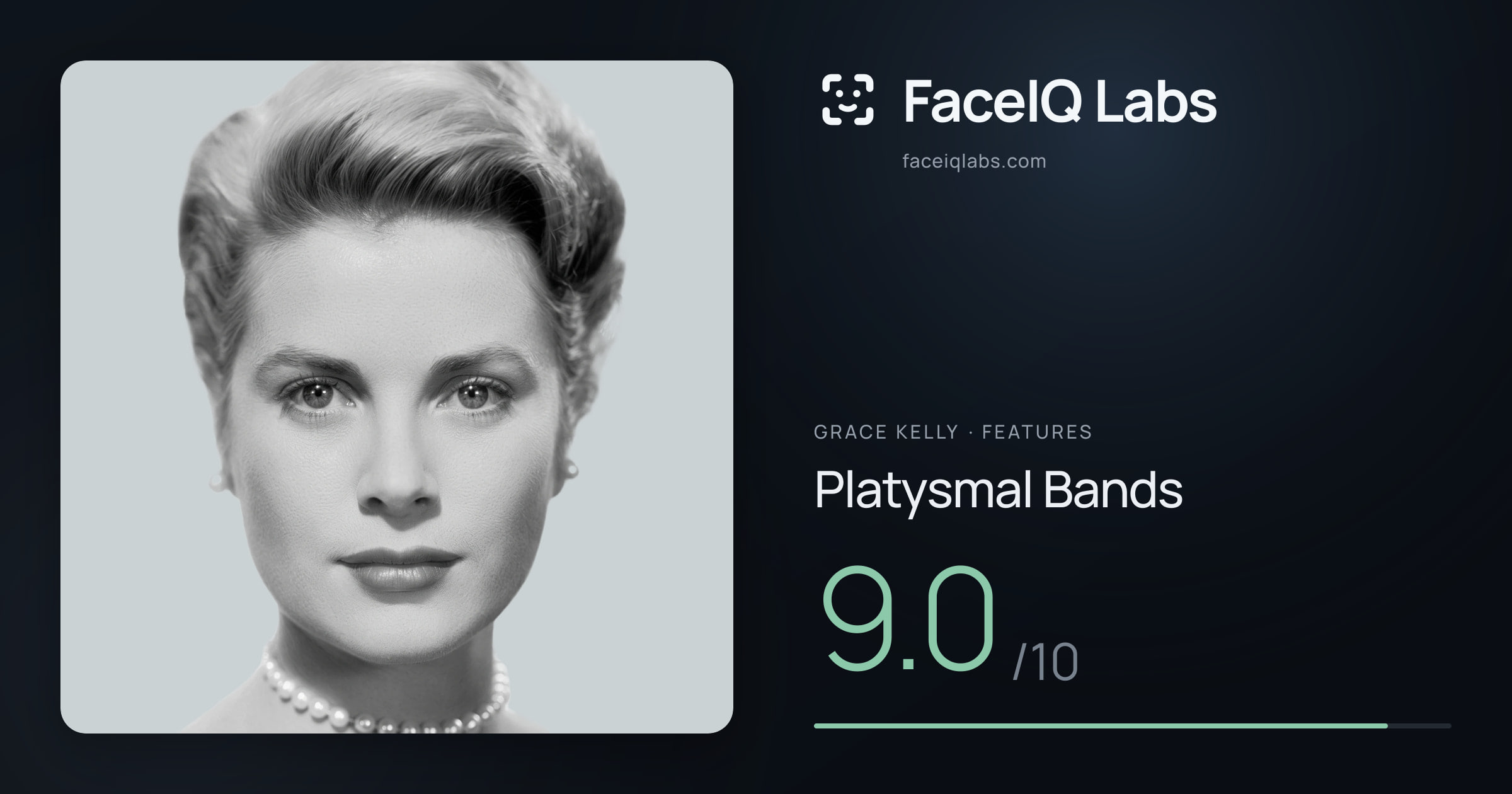 Grace Kelly Platysmal Bands: 9.0/10, drawn on the photo
