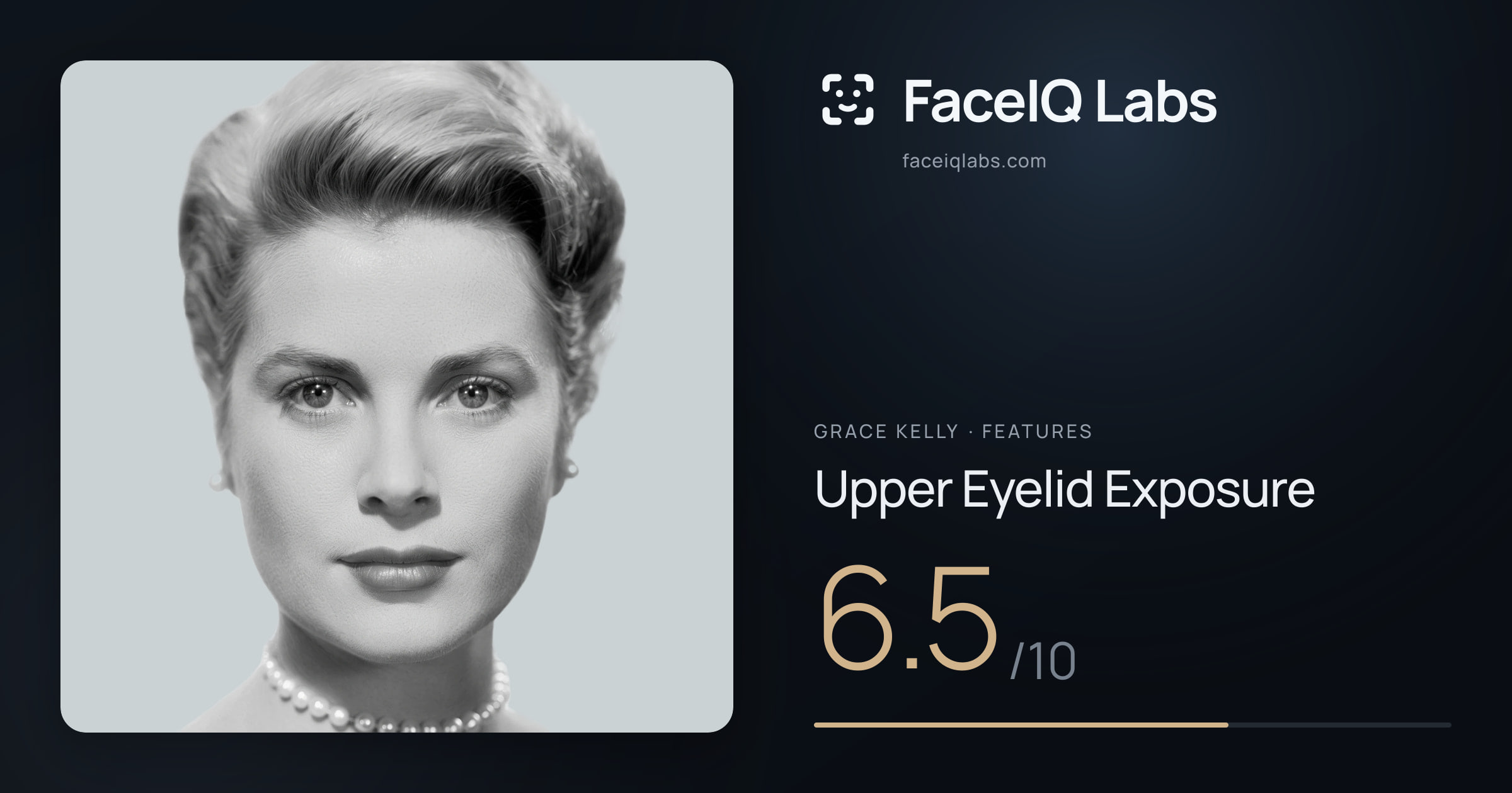 Grace Kelly Upper Eyelid Exposure: 6.5/10, drawn on the photo