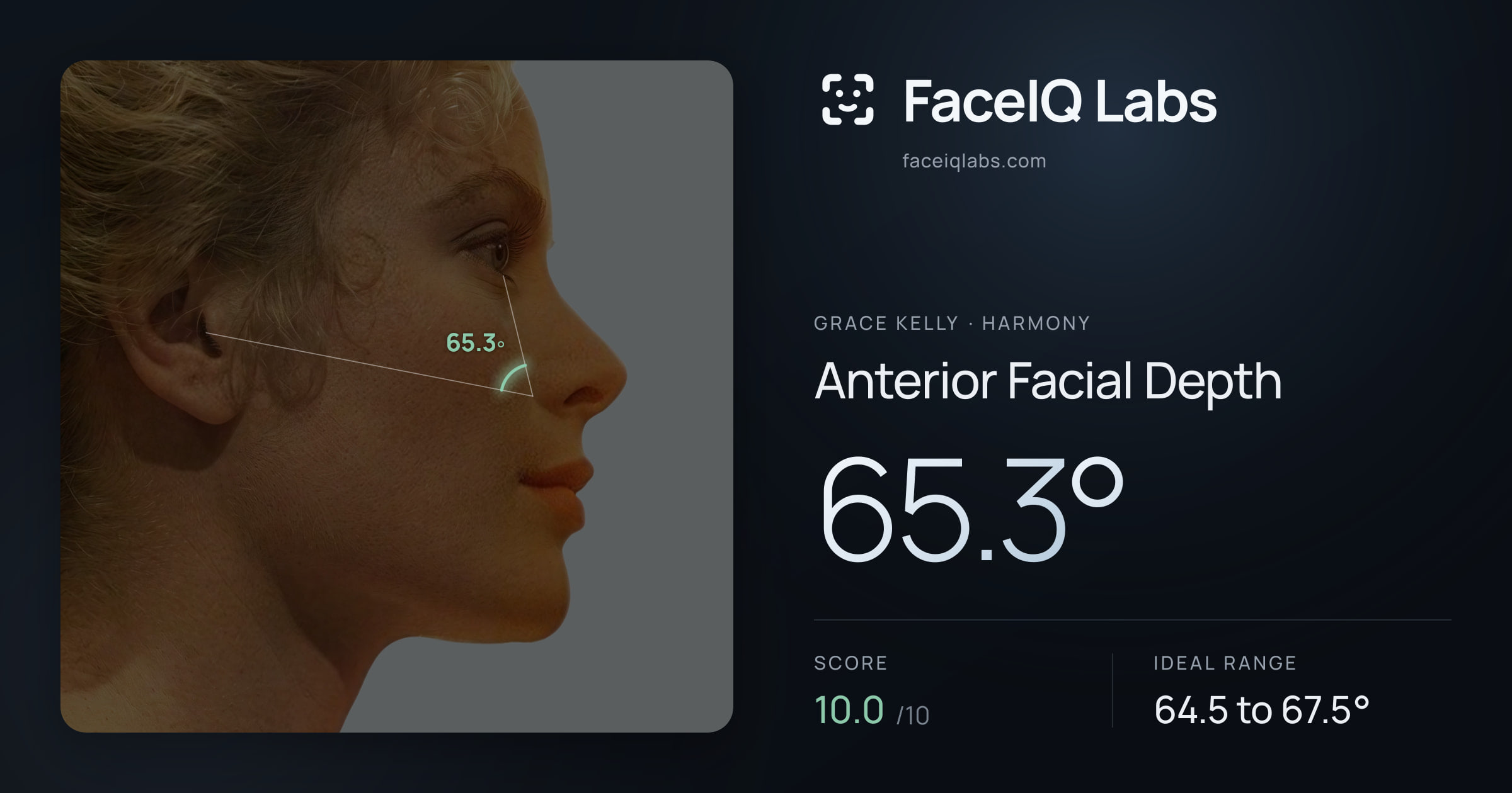 Grace Kelly Anterior Facial Depth: 65.3°, drawn on the photo