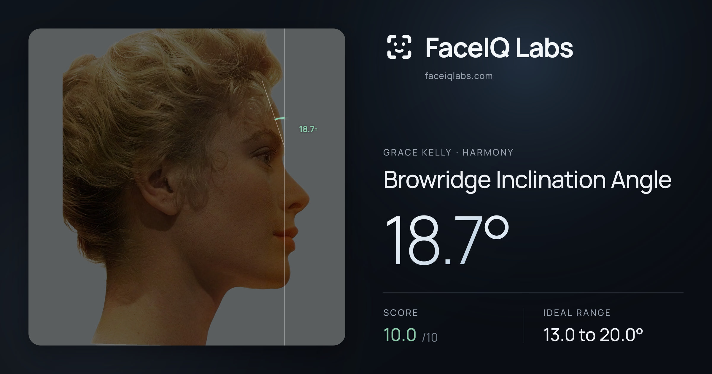 Grace Kelly Browridge Inclination Angle: 18.7°, drawn on the photo