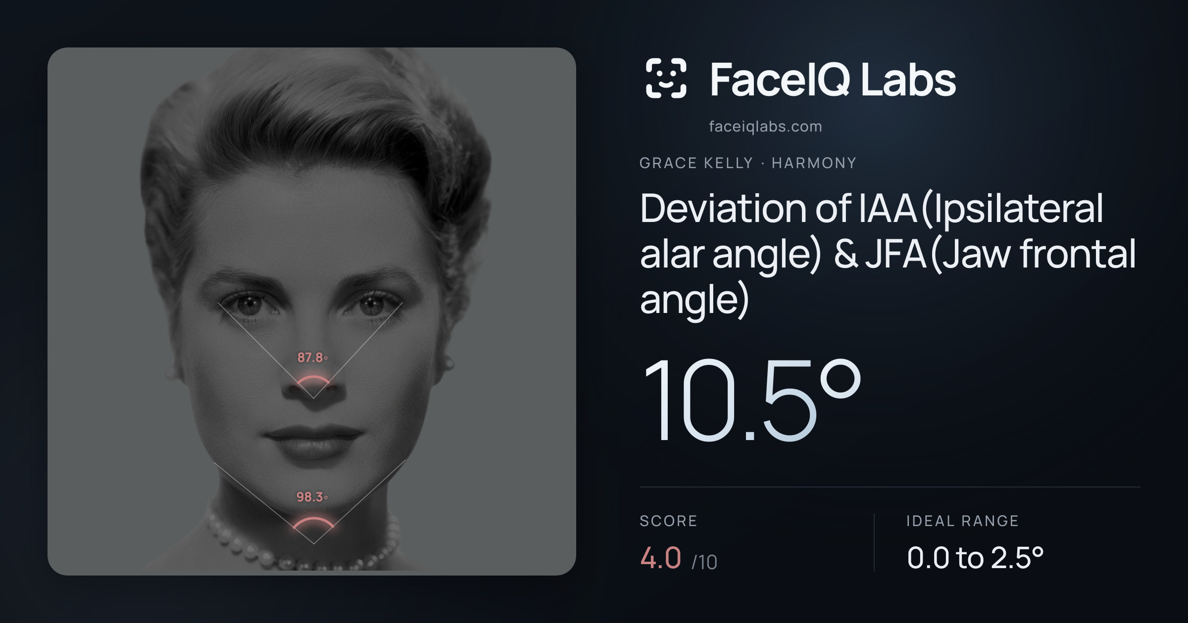 Grace Kelly Deviation of IAA(Ipsilateral alar angle) & JFA(Jaw frontal angle): 10.5°, drawn on the photo