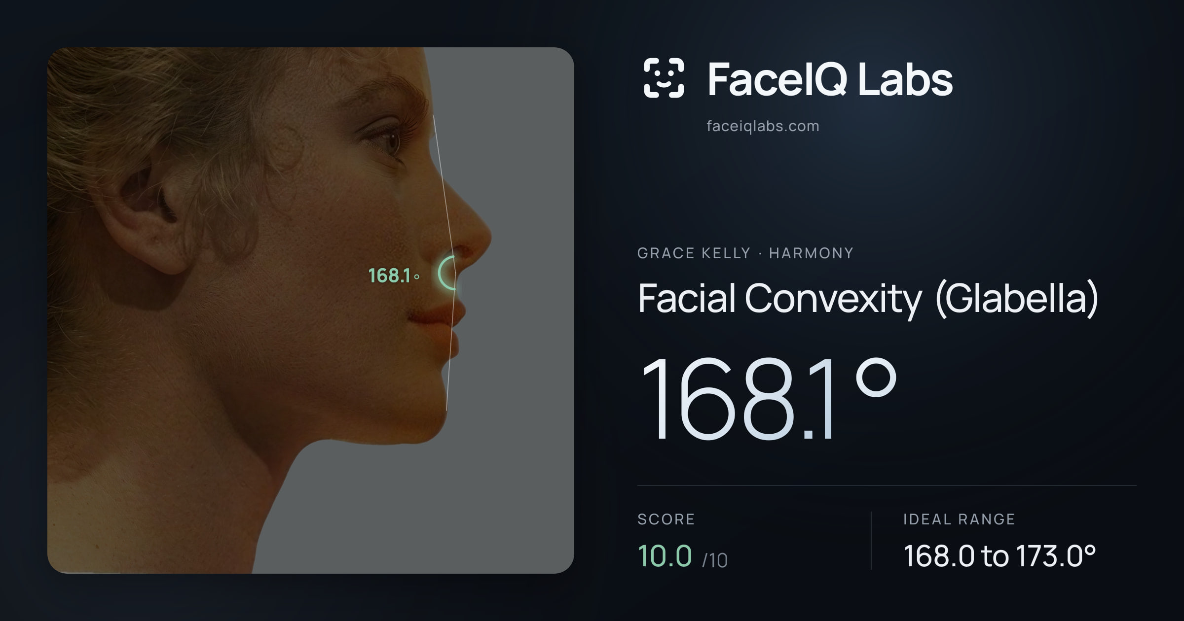 Grace Kelly Facial Convexity (Glabella): 168.1°, drawn on the photo