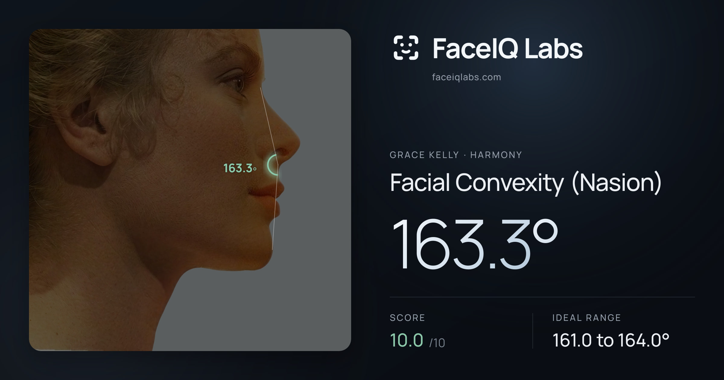Grace Kelly Facial Convexity (Nasion): 163.3°, drawn on the photo