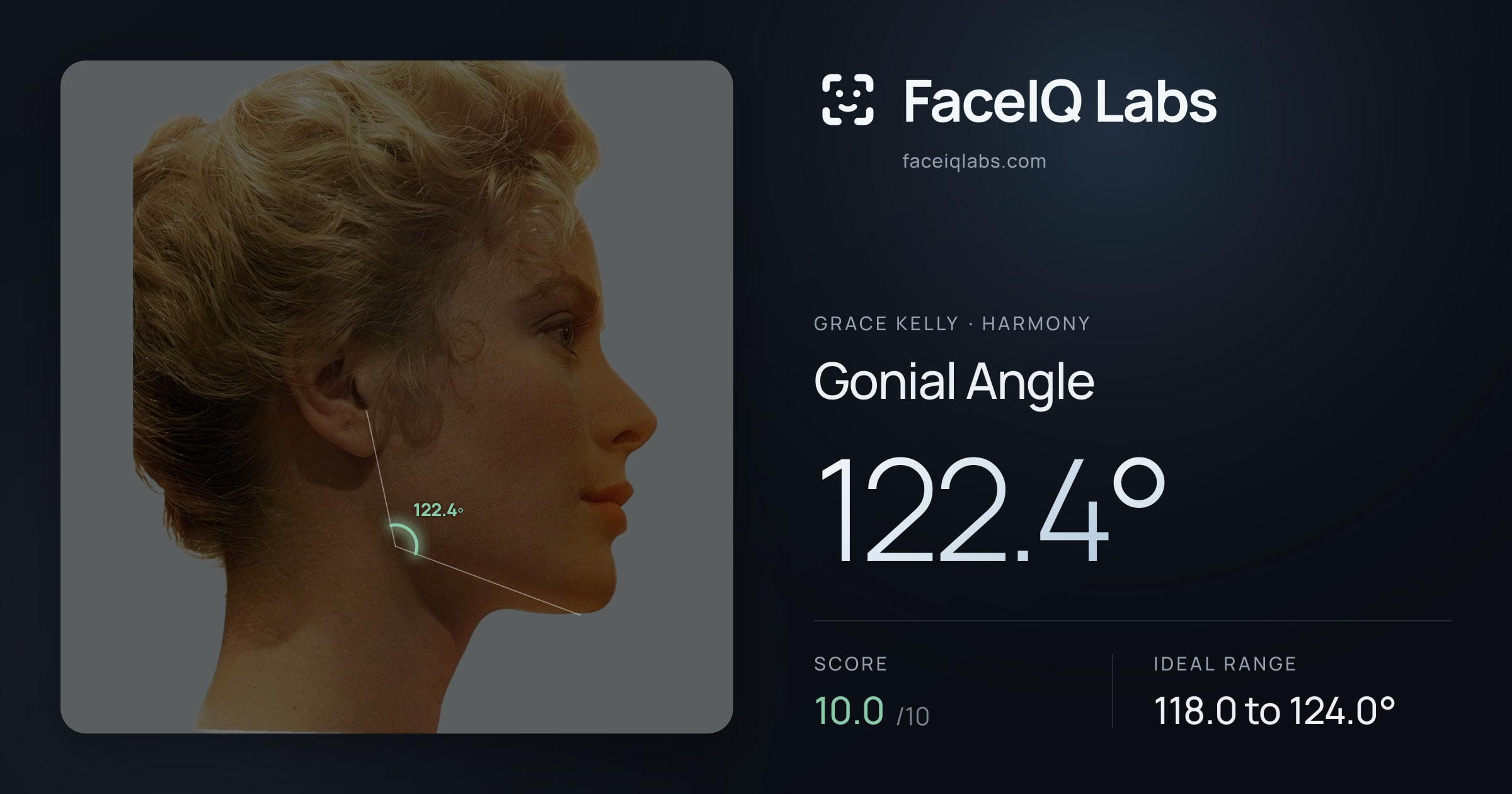 Grace Kelly Gonial Angle: 122.4°, drawn on the photo
