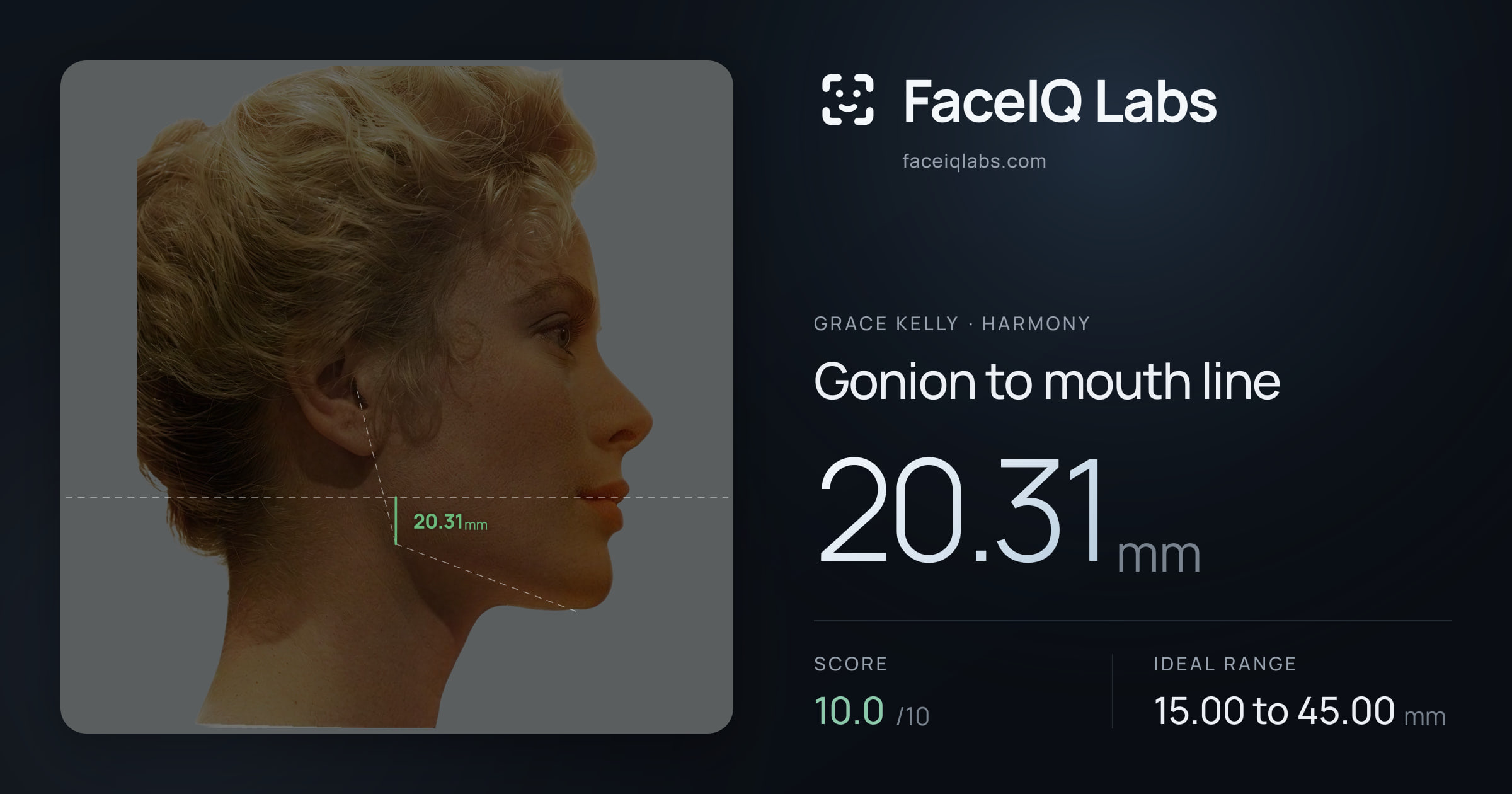 Grace Kelly Gonion to mouth line: 20.31mm, drawn on the photo