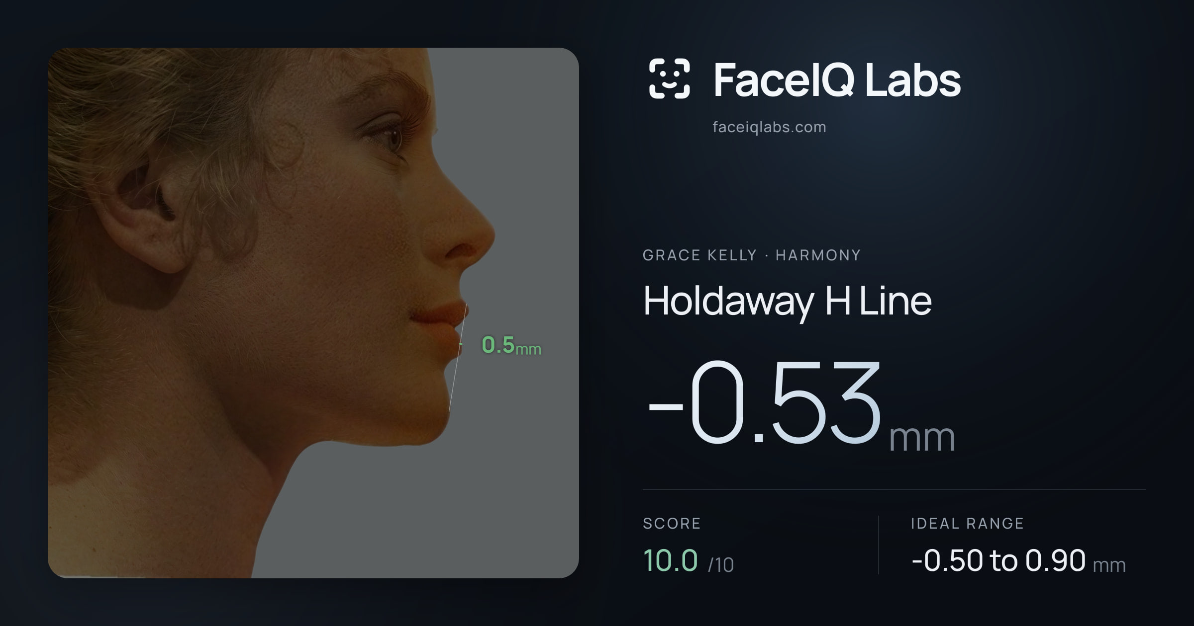 Grace Kelly Holdaway H Line: -0.53mm, drawn on the photo
