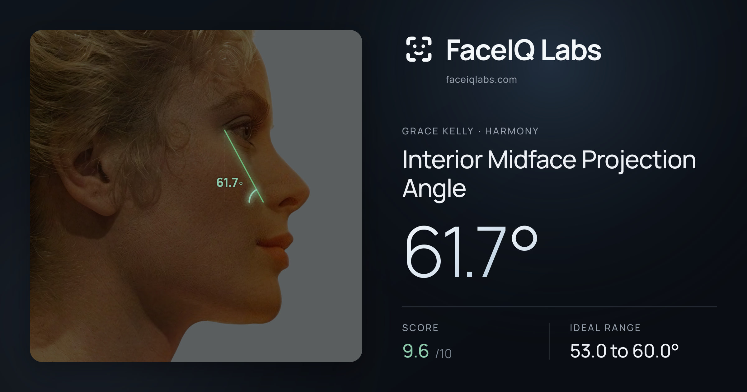 Grace Kelly Interior Midface Projection Angle: 61.7°, drawn on the photo