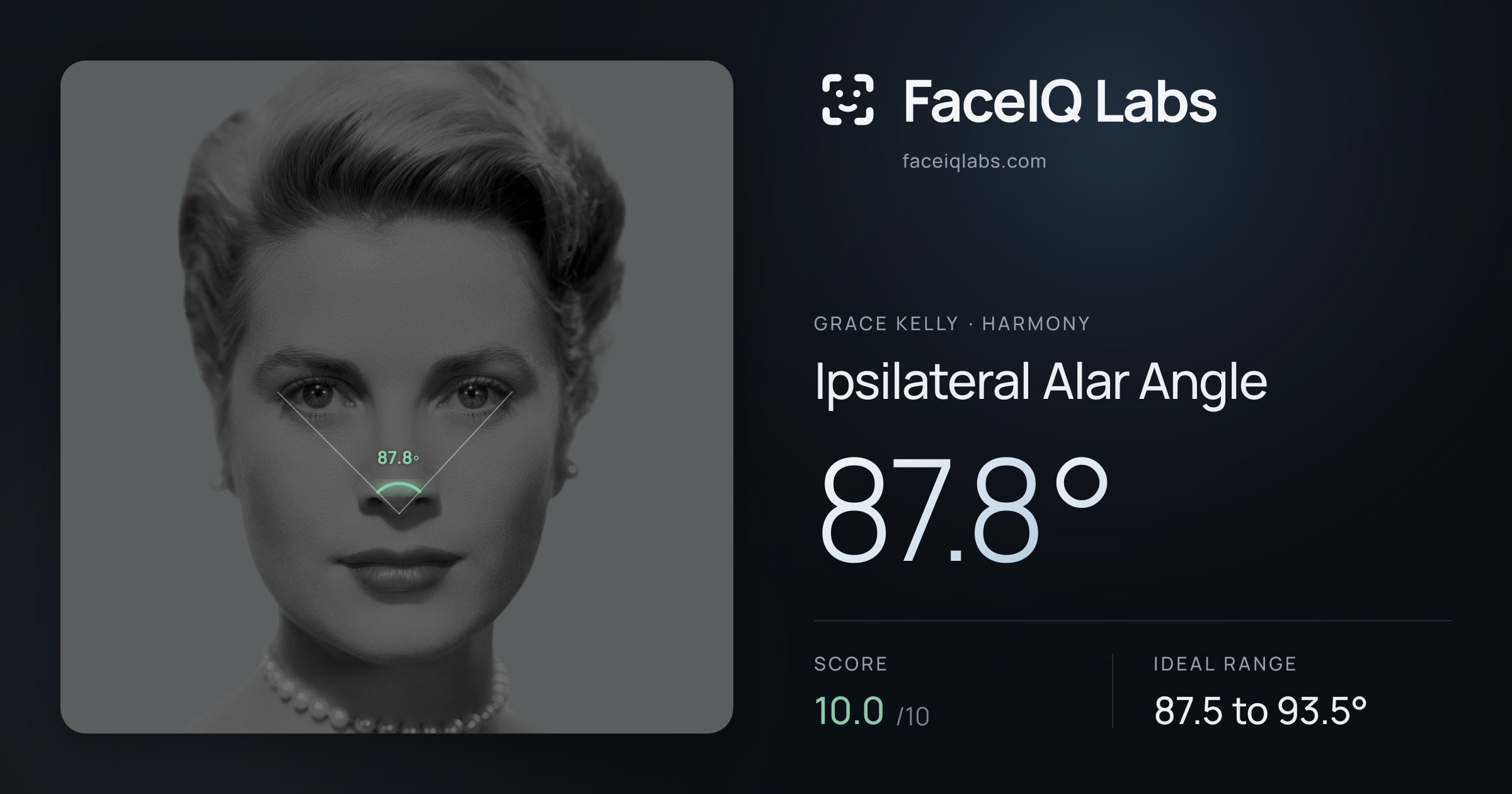 Grace Kelly Ipsilateral Alar Angle: 87.8°, drawn on the photo