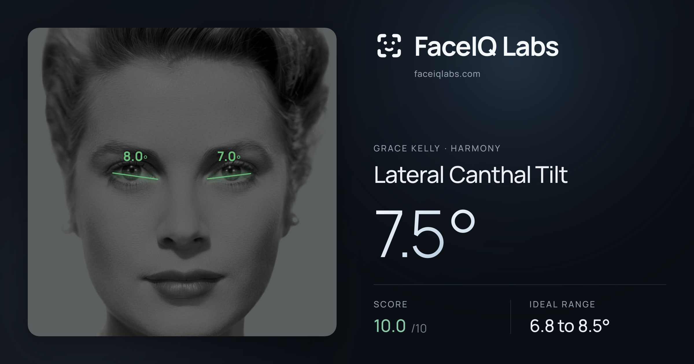 Grace Kelly Lateral Canthal Tilt: 7.5°, drawn on the photo
