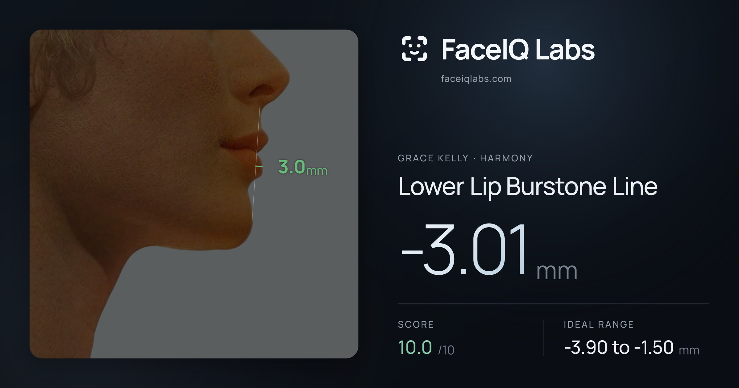 Grace Kelly Lower Lip Burstone Line: -3.01mm, drawn on the photo
