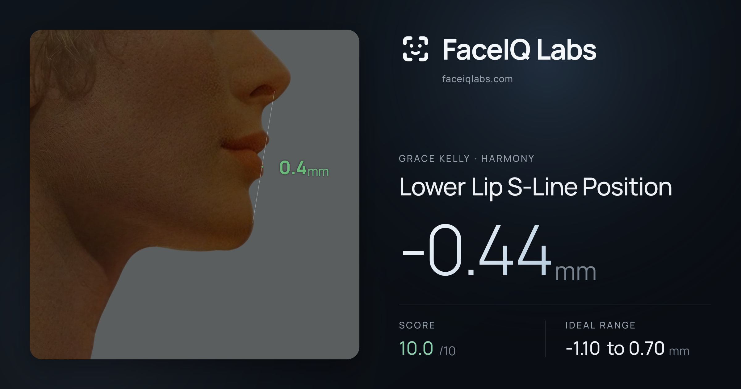 Grace Kelly Lower Lip S-Line Position: -0.44mm, drawn on the photo