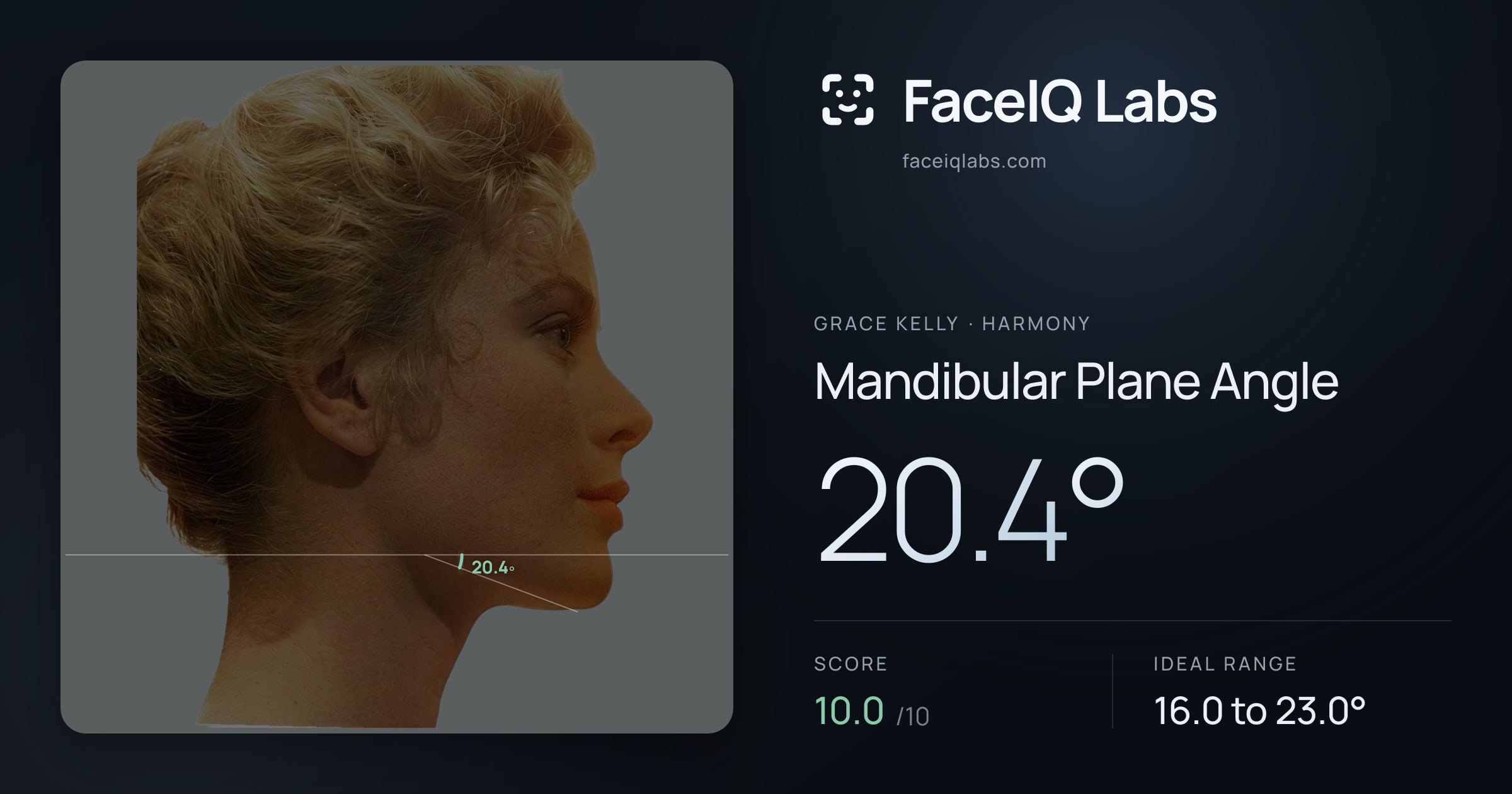 Grace Kelly Mandibular Plane Angle: 20.4°, drawn on the photo