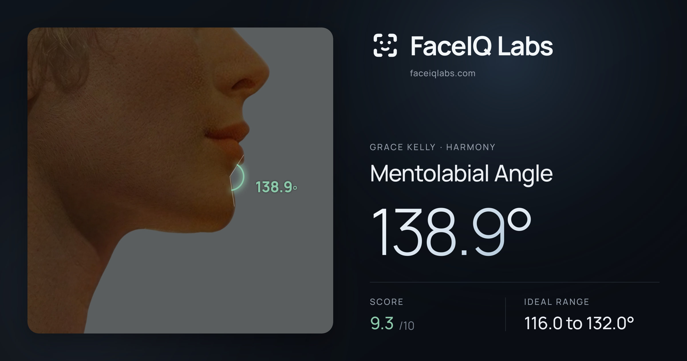Grace Kelly Mentolabial Angle: 138.9°, drawn on the photo