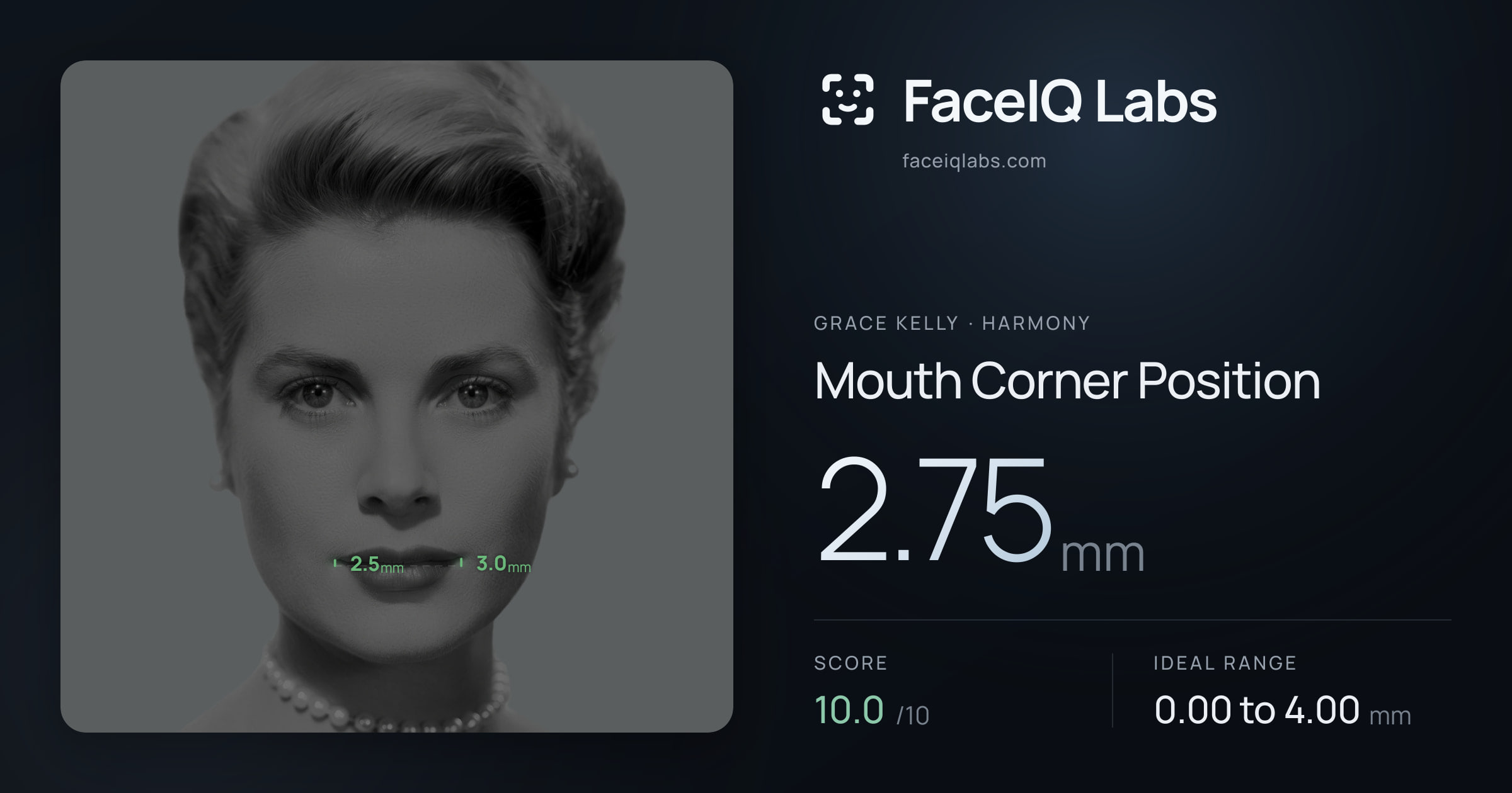 Grace Kelly Mouth Corner Position: 2.75mm, drawn on the photo