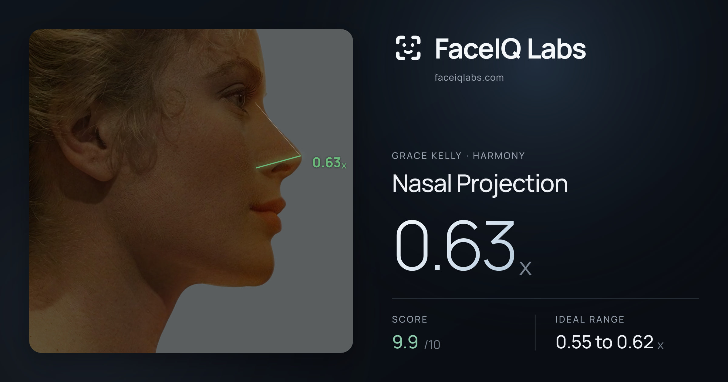 Grace Kelly Nasal Projection: 0.63x, drawn on the photo