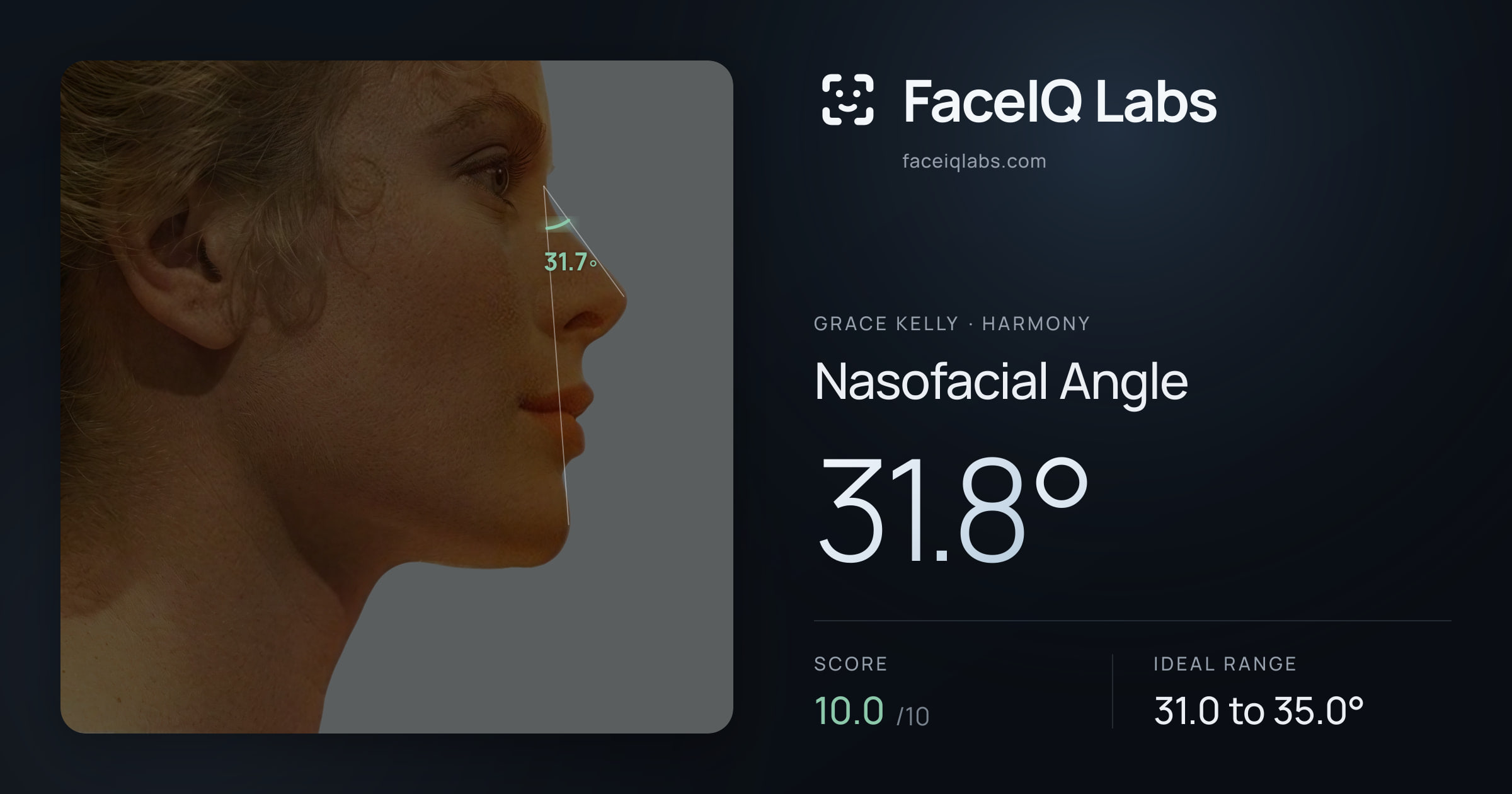Grace Kelly Nasofacial Angle: 31.8°, drawn on the photo