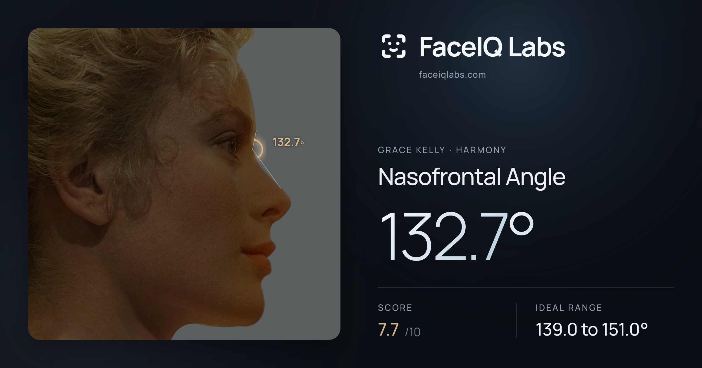 Grace Kelly Nasofrontal Angle: 132.7°, drawn on the photo