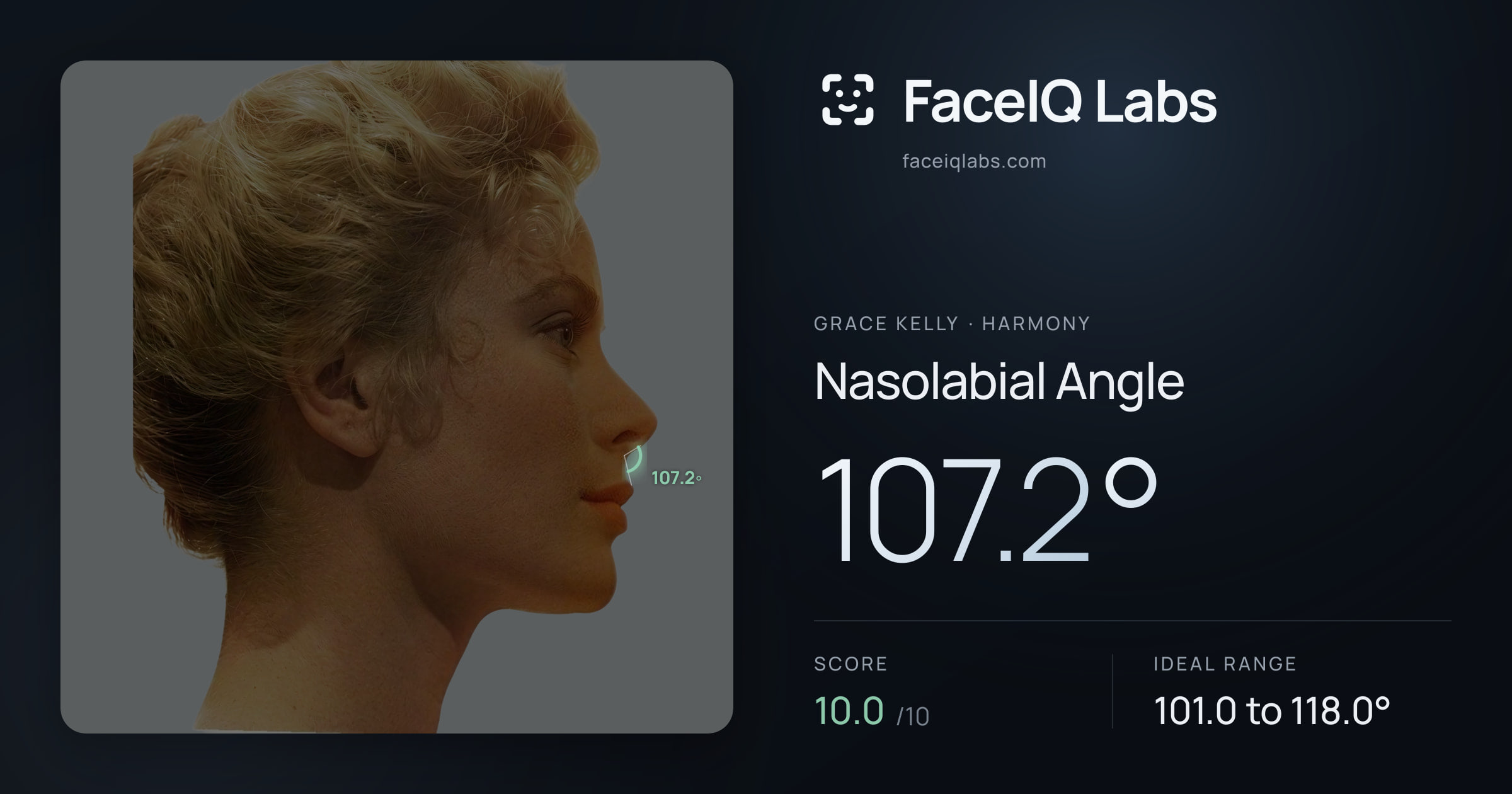 Grace Kelly Nasolabial Angle: 107.2°, drawn on the photo